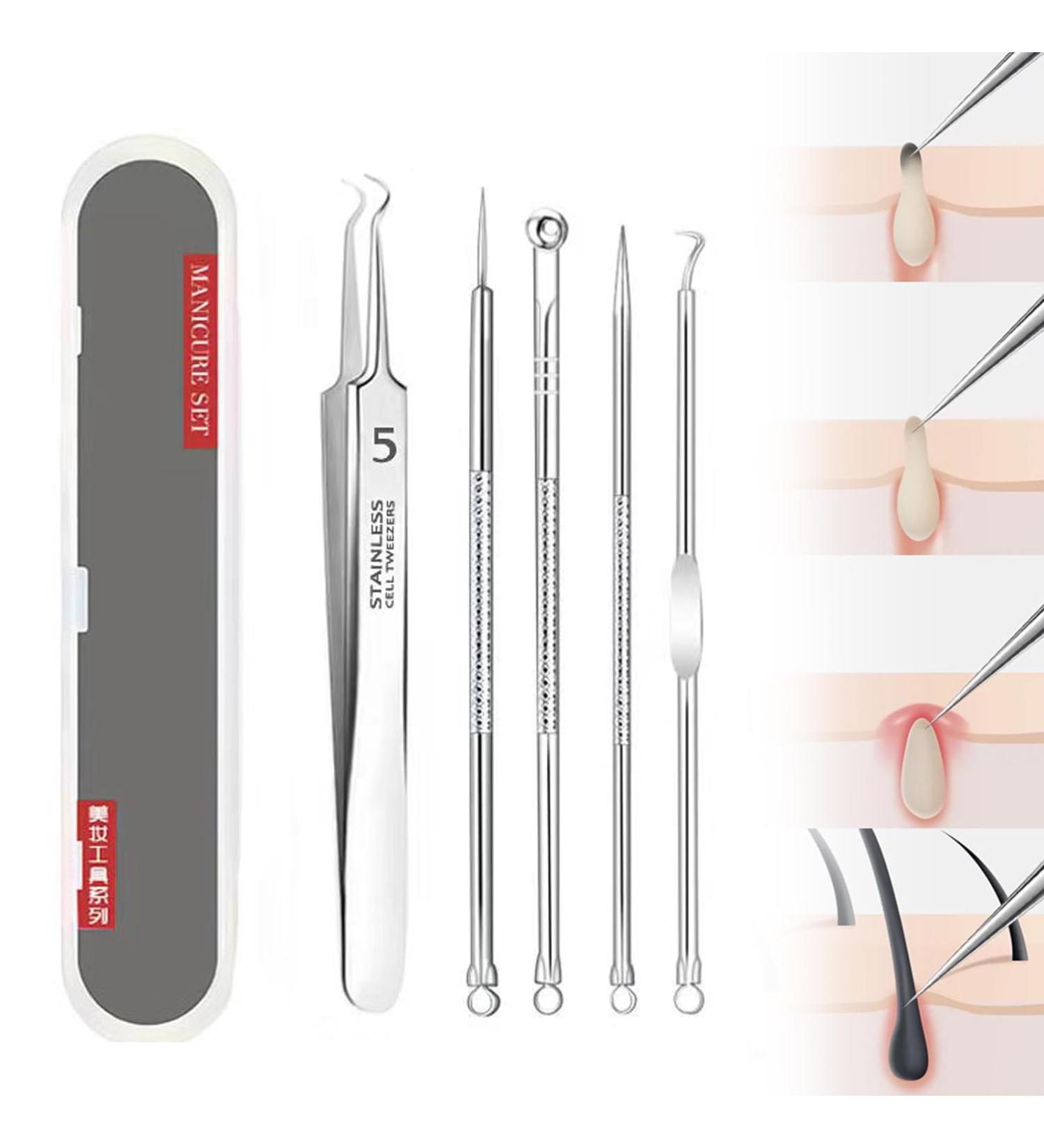 Usiveinborn Blackhead Remover Professional Facial Blackhead Remover Tweezers Stainless Steel Precision Pimple Popper Tool Kit Easy Removal of Pimples Blackheads Zit Removing Forehead (F) - Buy Online on GoSupps.com
