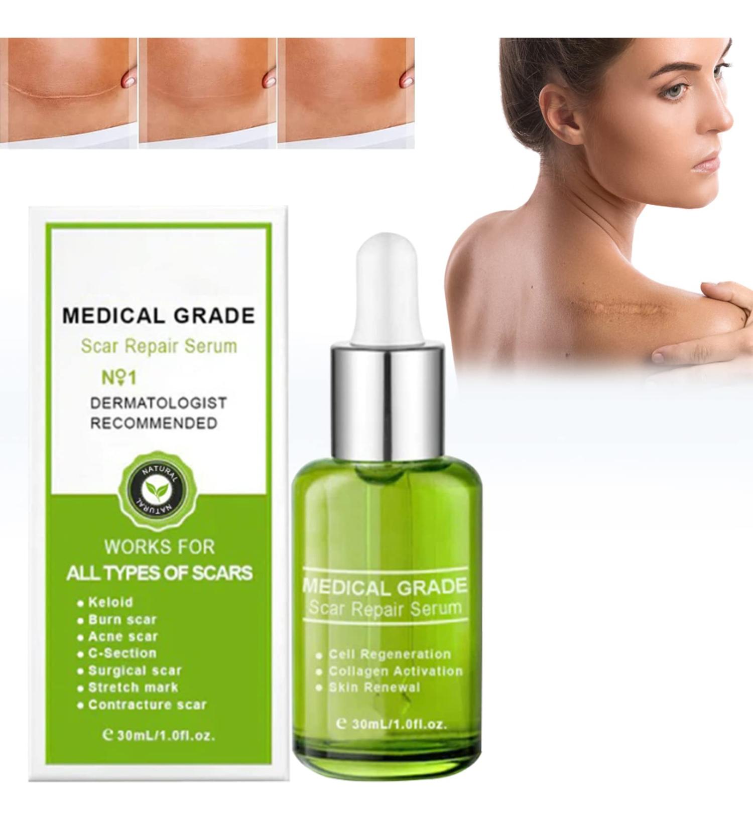 30ml Goopgen Medical Grade Scar Repair Serum - Nature Scar Treatment for All Types of Scars (1pcs) - Buy Online on GoSupps.com