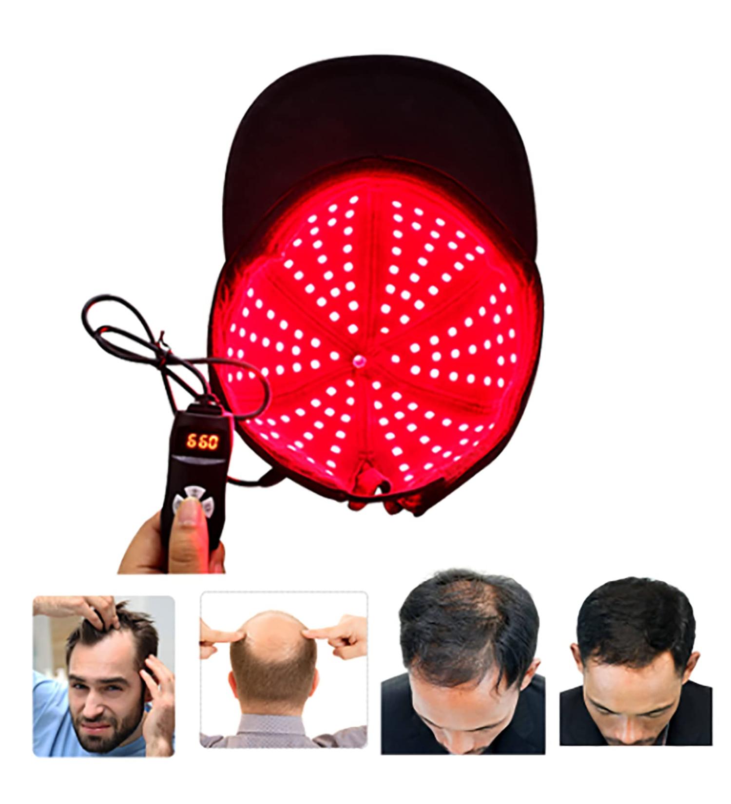 Infrared & Red Light Therapy Cap 150 LEDs Hair Regrowth Helmet for Hair Follicle Thinning Hair Care Hair Follicle Healing Headwear - Buy Online on GoSupps.com