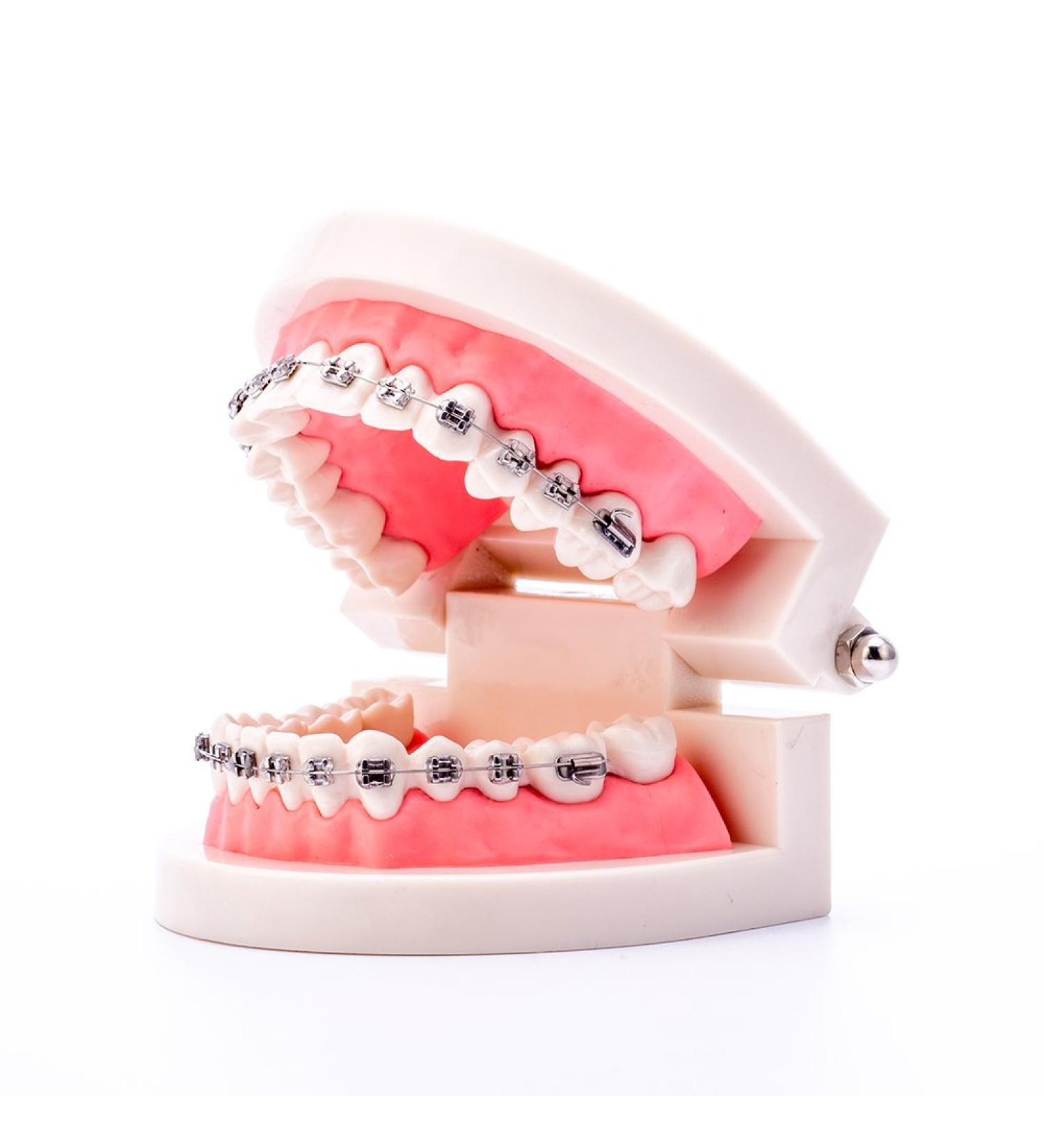 Buy Dental Orthodontic Standard Teeth Model with Metal Brackets & Wires - International Shipping Available - Buy Online on GoSupps.com