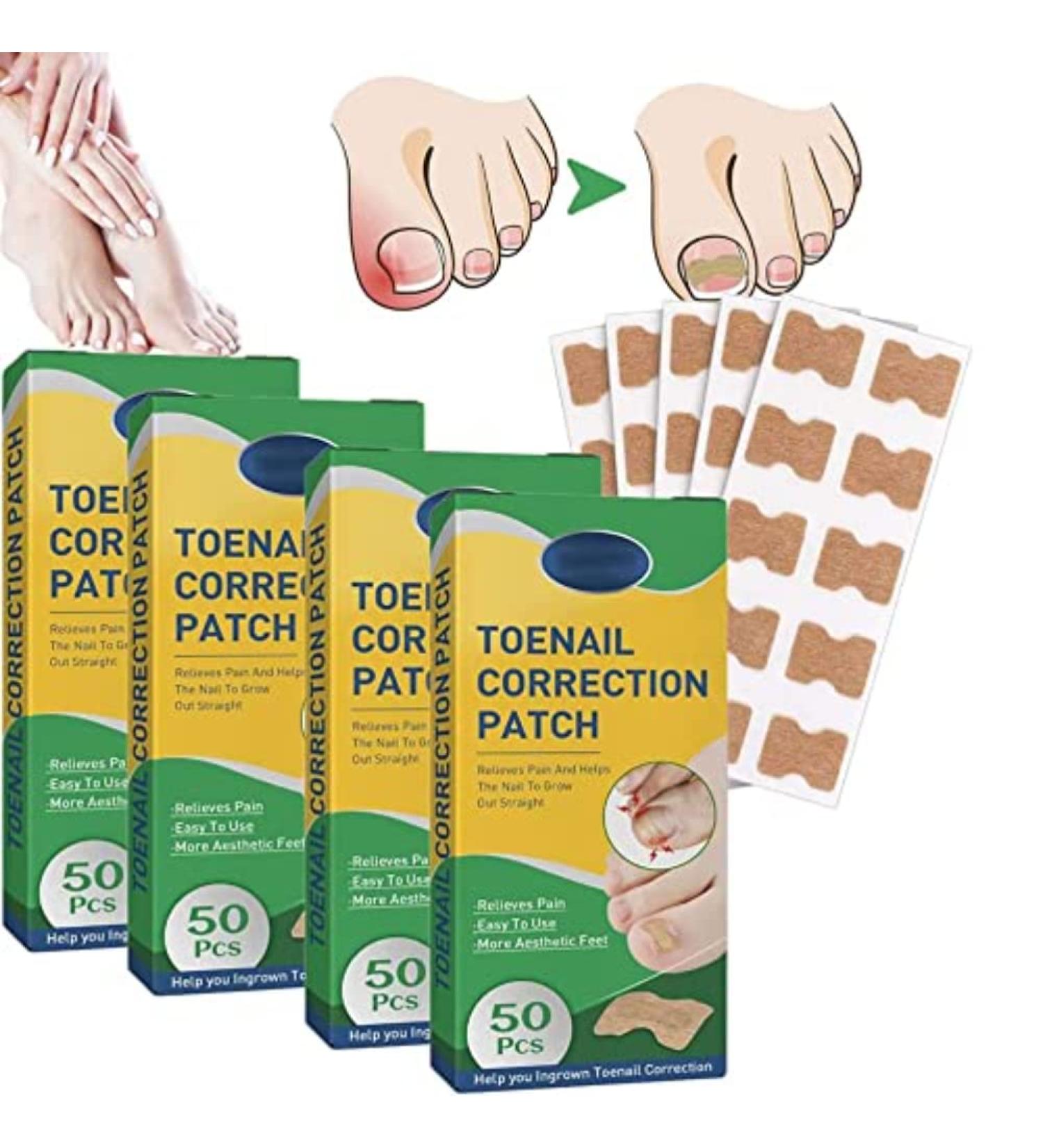 200pcs Ingrown Toenail Corrector Strips - Fitmedify Nail Patches for Toe Nails Fungus - Relief for Ingrown Toenails - Buy Online on GoSupps.com