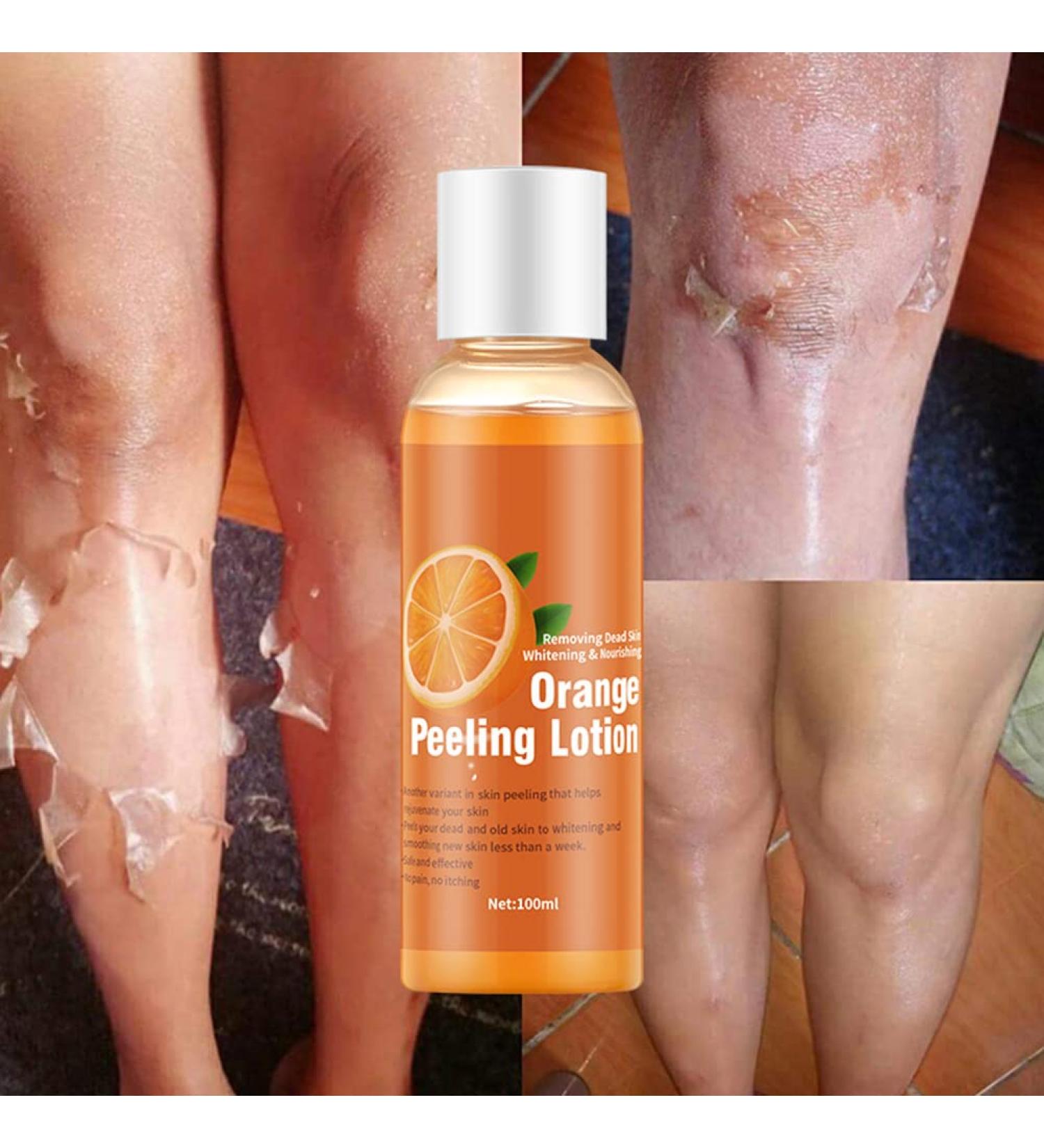 HUSHUI Orange Peeling Lotion | Skin Whitening & Gentle Peeling Gel for Body Care - Buy Internationally - Buy Online on GoSupps.com