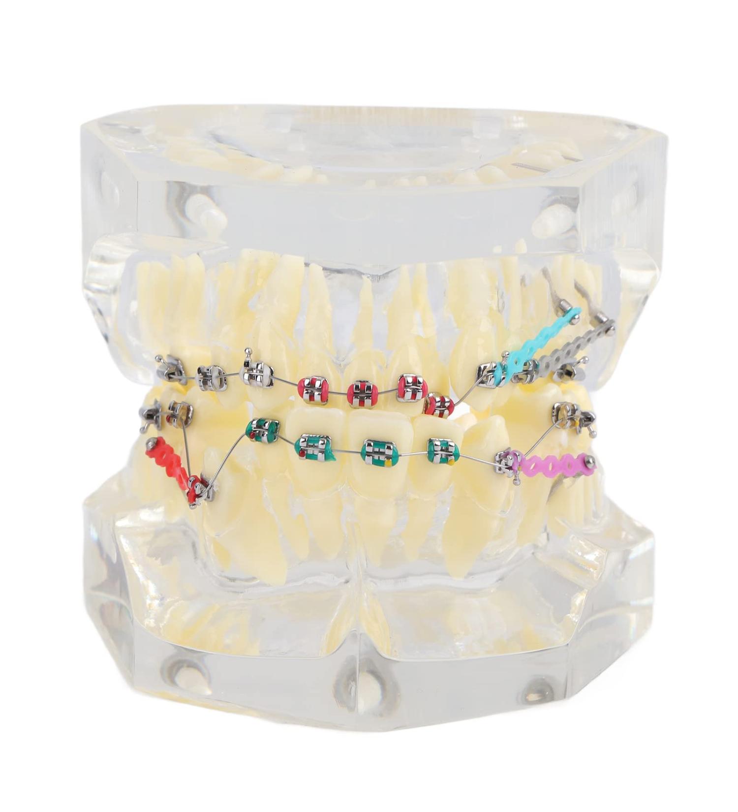 Orthodontic Model PVC Resin for Malocclusion Treatment - Adult & Child Dental Education Model with Wire Chain - Buy Online on GoSupps.com