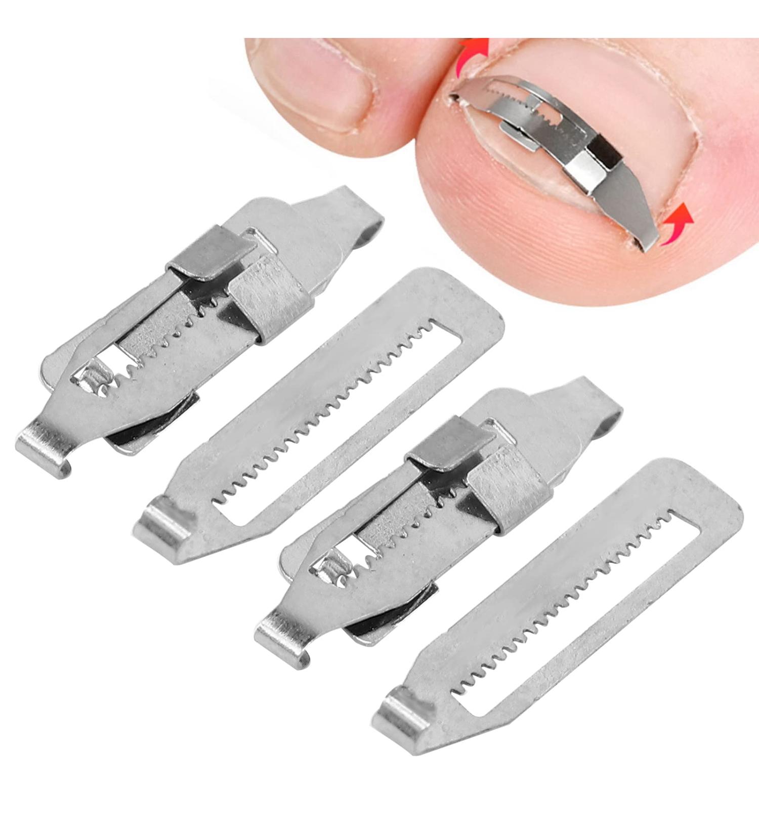 Stainless Steel Ingrown Toenail Corrector - Paronychie Tool Set (2 Pieces) | Pedicure Solutions for Nail Correction - Buy Online on GoSupps.com