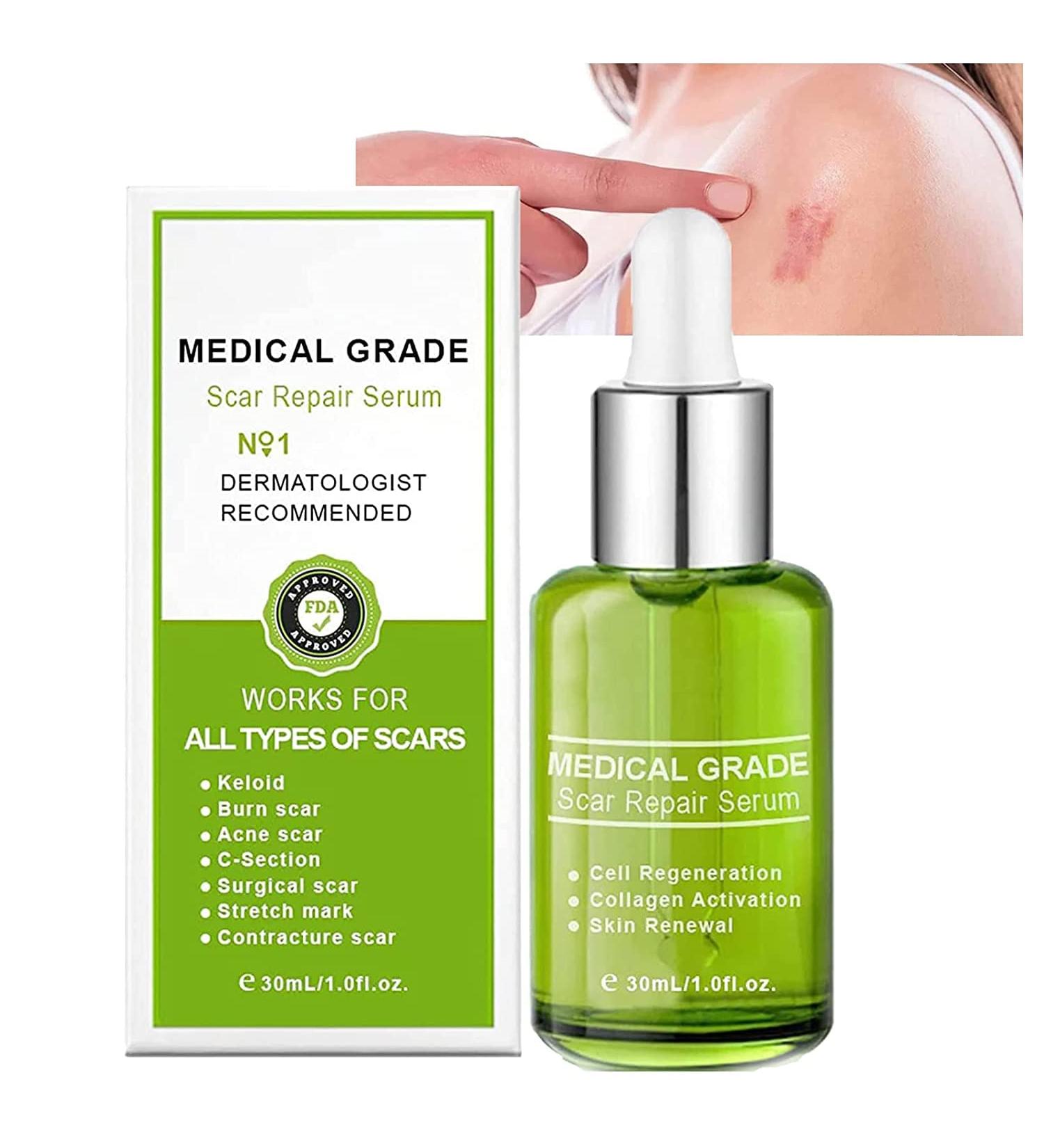 Goopgen Advanced Scar Repair Serum - Medical Grade Treatment for All Types of Scars - Buy Online on GoSupps.com