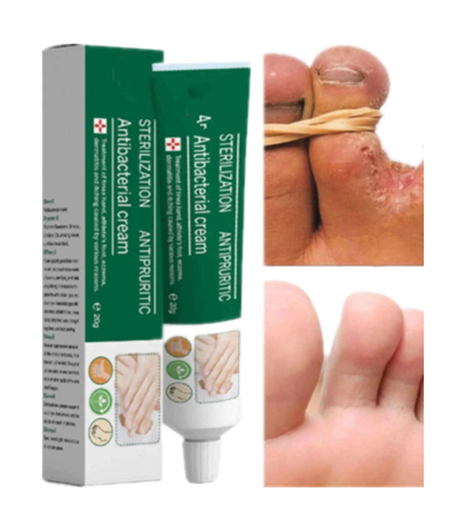 Moisturizing Antipruritic Ointment for Dry Skin Peeling on Hands and Feet - Buy Online on GoSupps.com