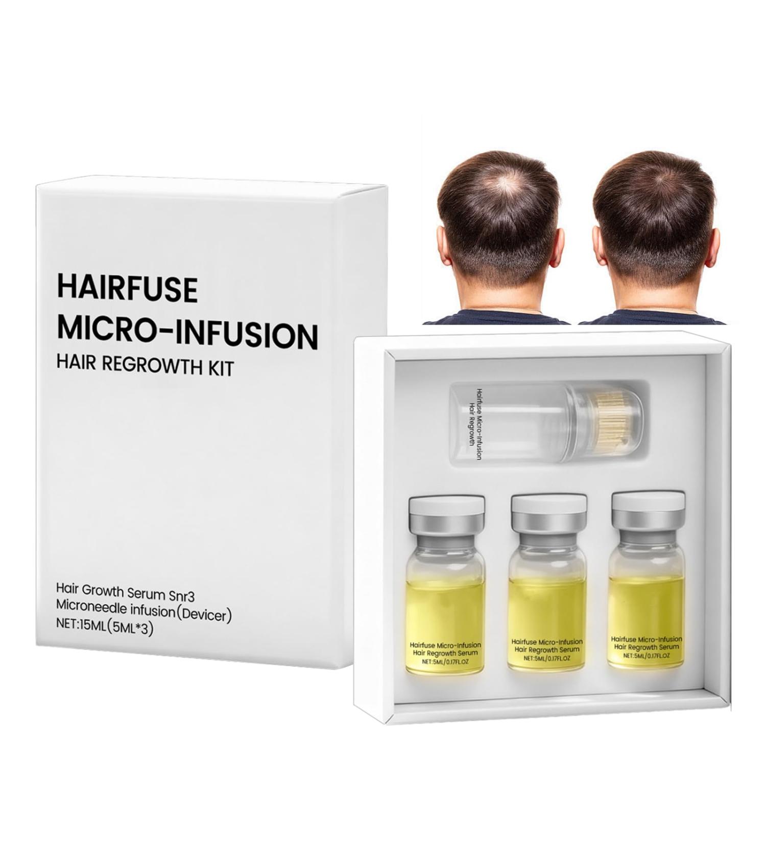 Micro Infusion Cheveux Colagea Micro Infuse Cheveux Homme Repousse Cheveu-x Favorise Pousse Chev-eux Rend Cheveu-x Plus pais Fortifie Racines(5ml*3) - Buy Online on GoSupps.com