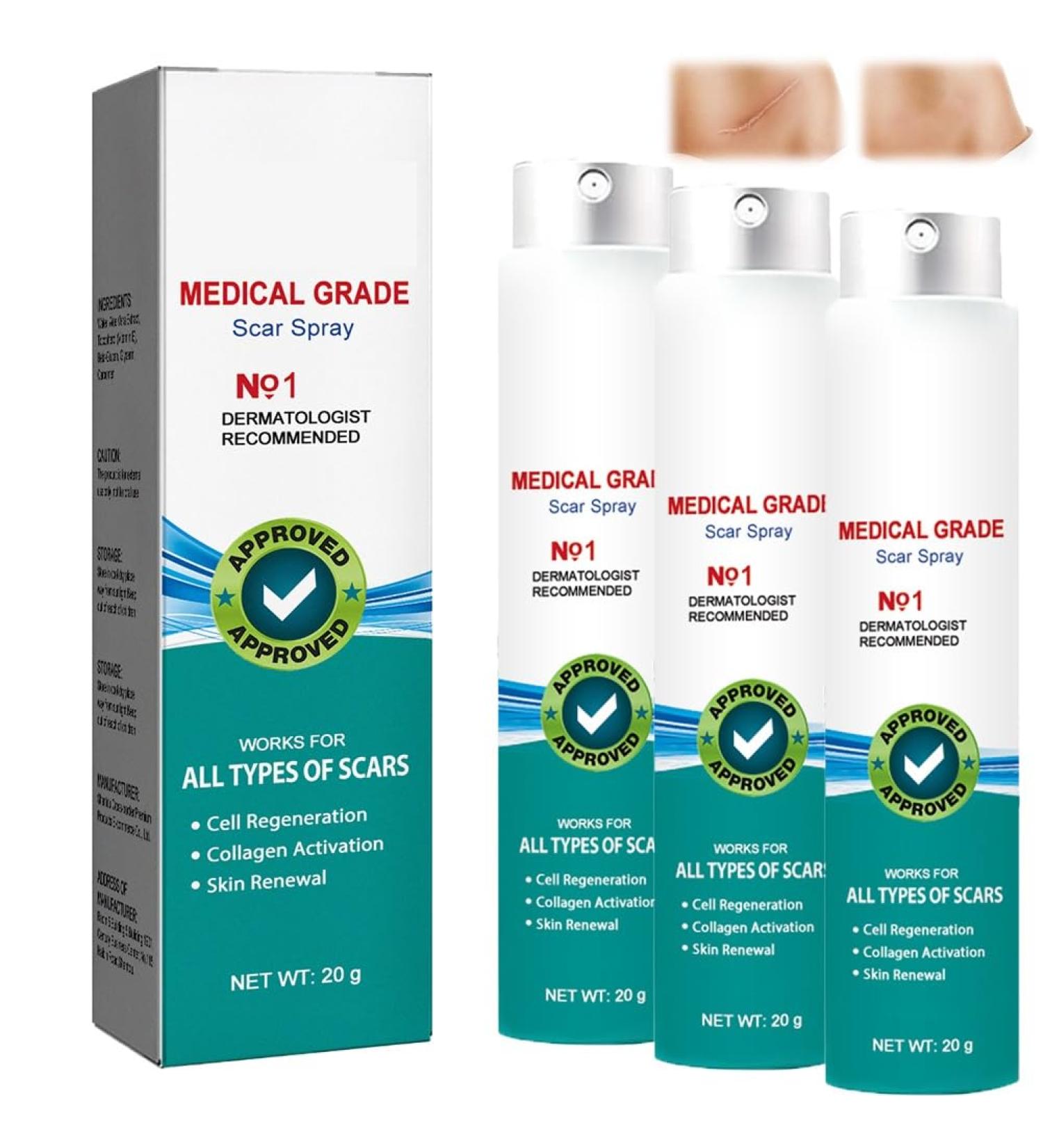 YDOJ Scar Remove Advanced Spray | Gentle Skin Care & Treatment for All Types of Scars - 3pcs - Buy Online on GoSupps.com
