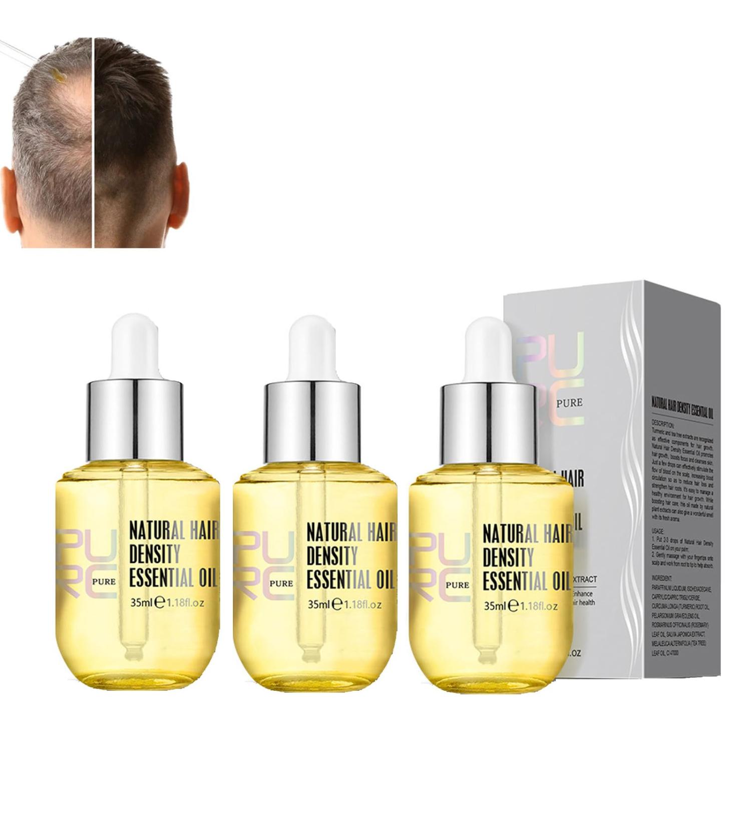 Purc Natural Essential Oil for Hair Growth | Boost Density & Prevent Hair Loss | Scalp Treatment (3 Pieces) - Buy Online on GoSupps.com