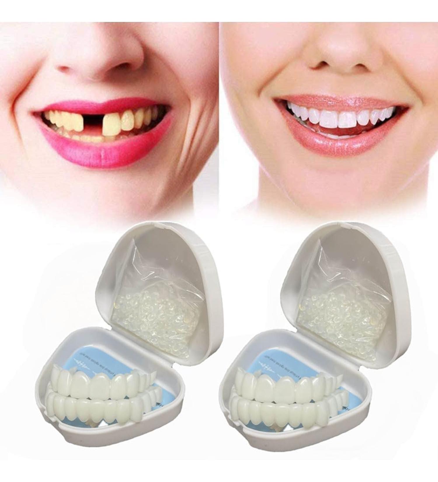 Flipped Warm 2 Pairs of Cosmetic Teeth - Easy Plug-in Dentures & Lightening Veneers for Bad Teeth | International Shipping - Buy Online on GoSupps.com