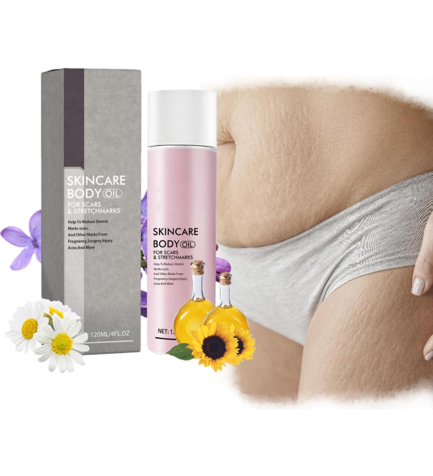 KARLOR Body Oil for Pregnancy Stretch marks Body Oils for Scars Pregnancy Stretch Mark Prevention Skin Care Oil Body Reduce streth makrs scars & Marks form pregnancy injury acne(120ml) - Buy Online on GoSupps.com