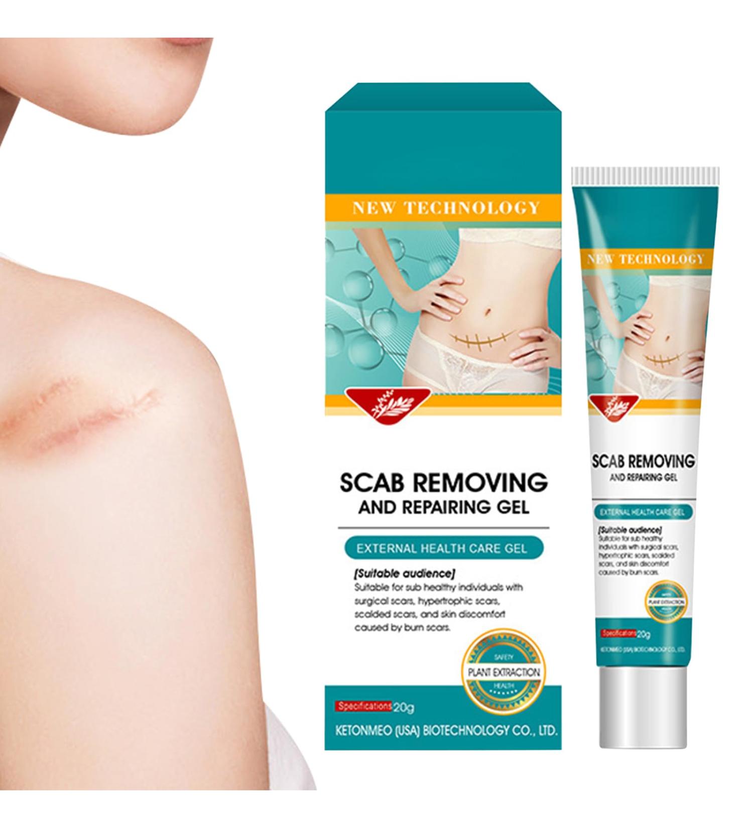 Scar Cream - 20g Soothing - Advanced Repair Cream for Scars For Comfort Recovery Burn Protection Domestic Body Injury - Buy Online on GoSupps.com