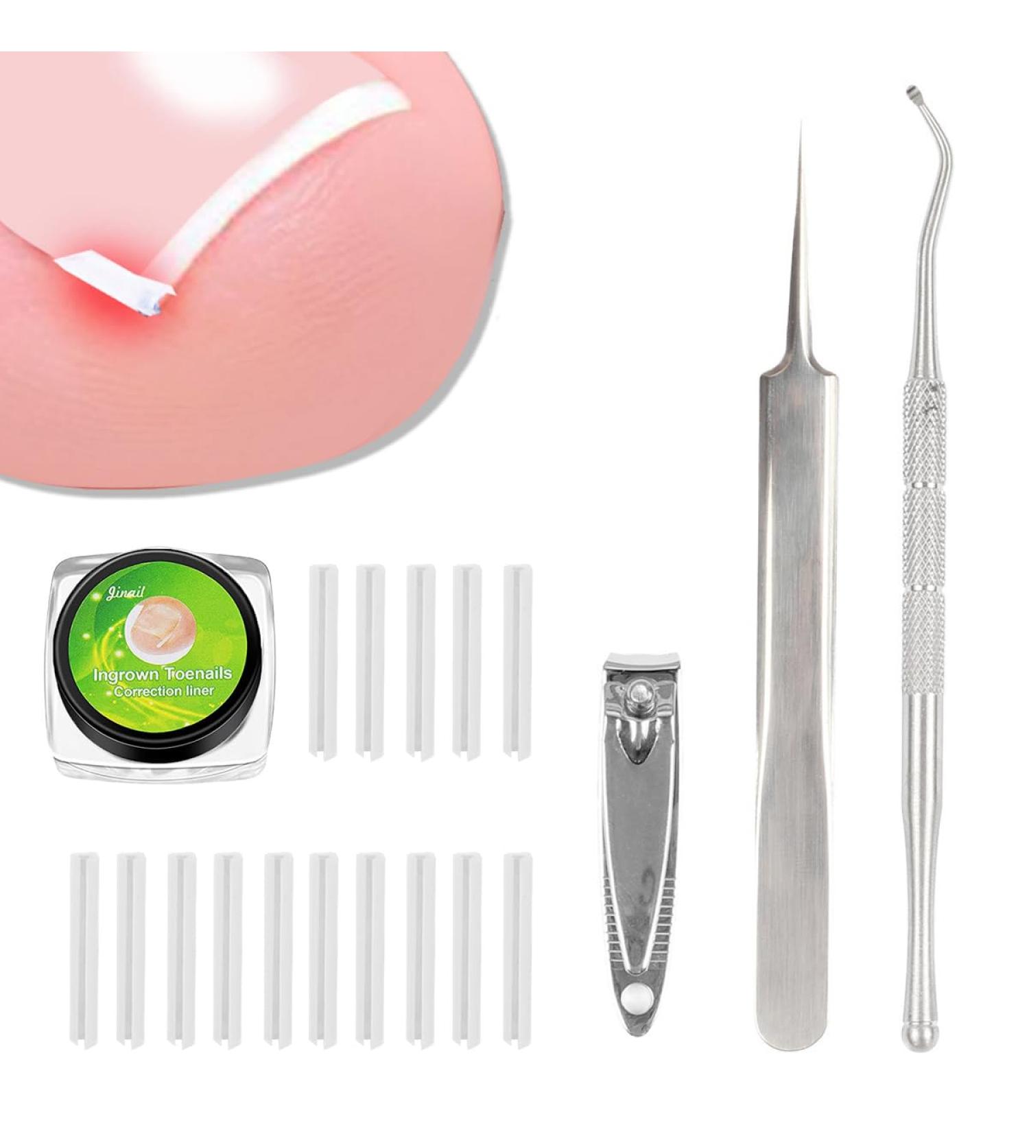 (12 +3) Ingrown Toenail Correction Treatment Kit Ingrown Toenail Correction Strips Brace Kit Ingrown Toenail File and Lifter Ingrown Toenail Corrector Straightener Strips for Nail Foot Care - Buy Online on GoSupps.com