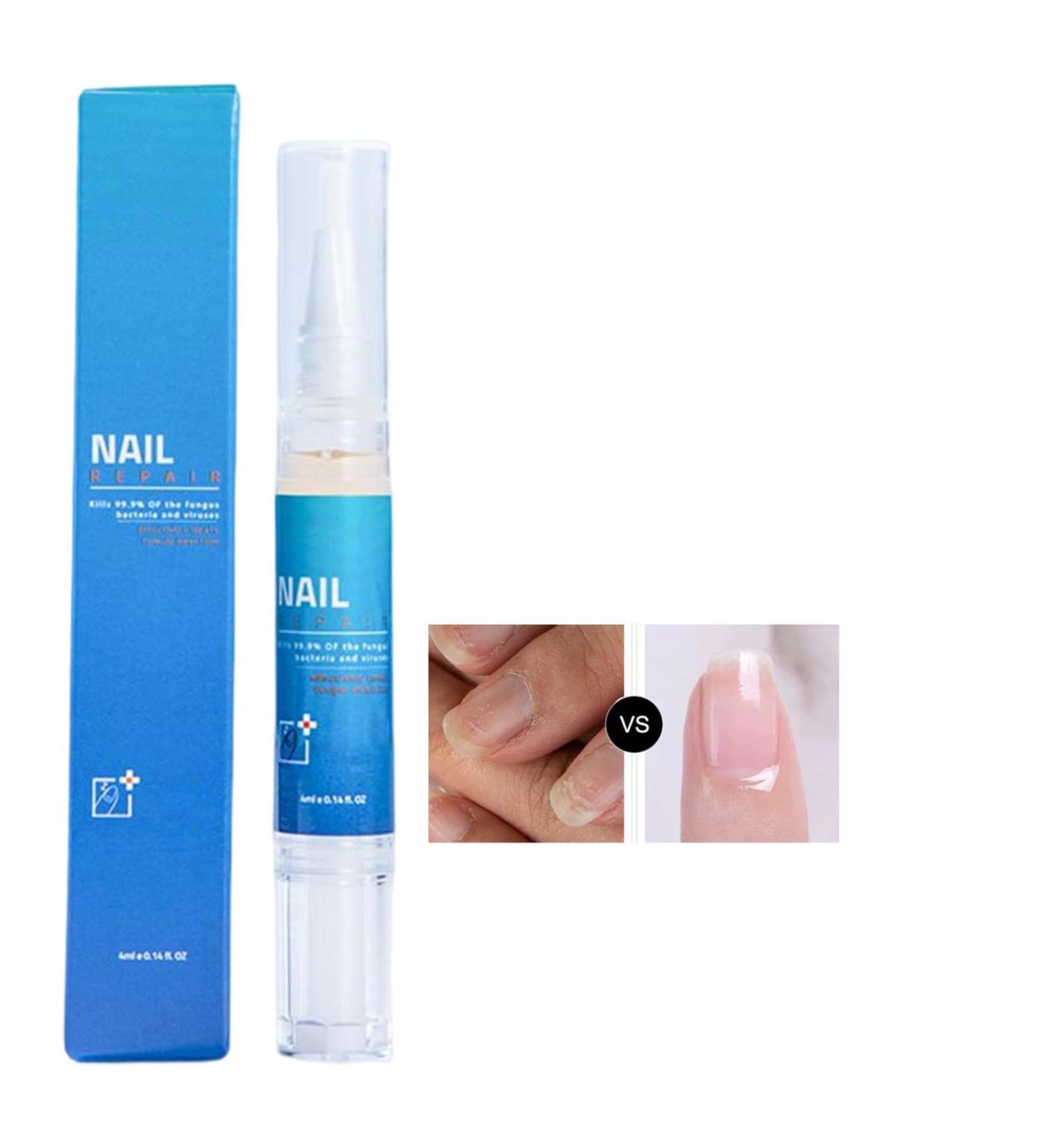 Stylo pour cuticules - Huile fortifiante pour la croissance des ongles - Stylo hydratant | pour Adultes Femmes Personnes g es Maison Voyage Salon - Buy Online on GoSupps.com