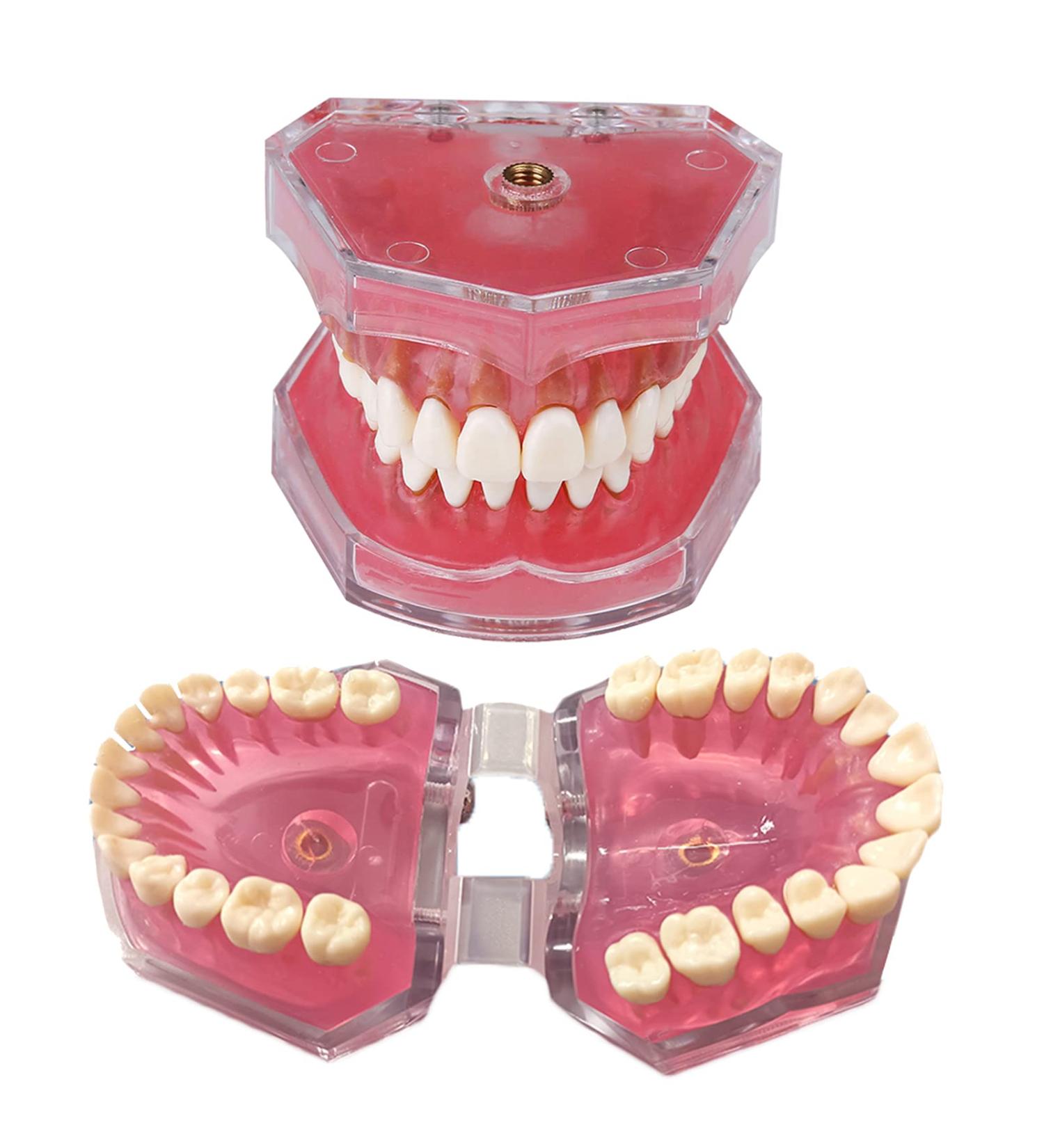 Tooth Lessons Model - Dental Simulation & Standard Practice Demonstration | Resin Dentist Teaching Tool (Pink Rose) - International Shipping Available - Buy Online on GoSupps.com