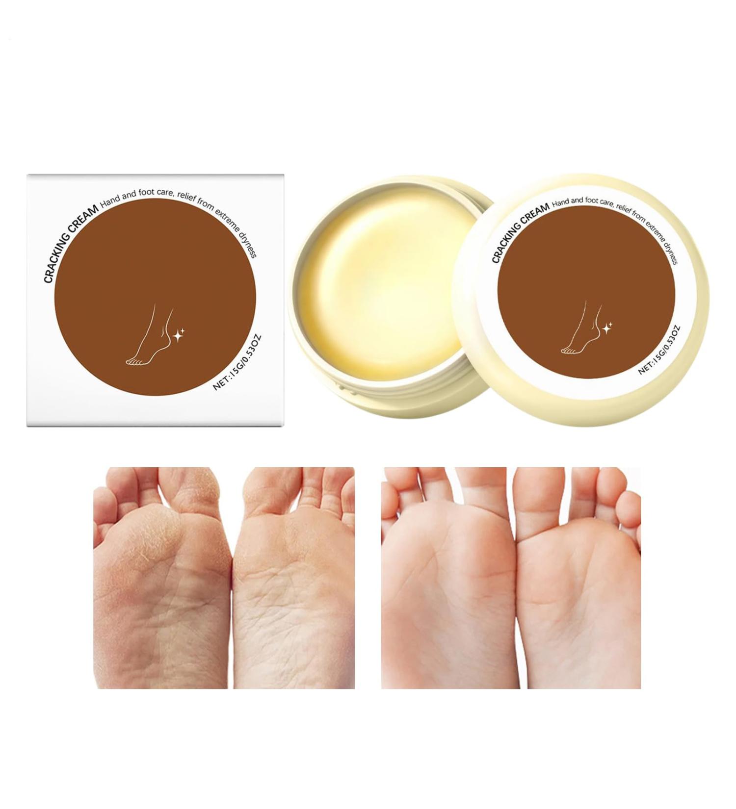  laxreheye Women's hand cream anti-crack heel softener - Moisturizing lotion for dry hands dead skin feet calluses men young people athletes healthy fingers - Buy Online on GoSupps.com