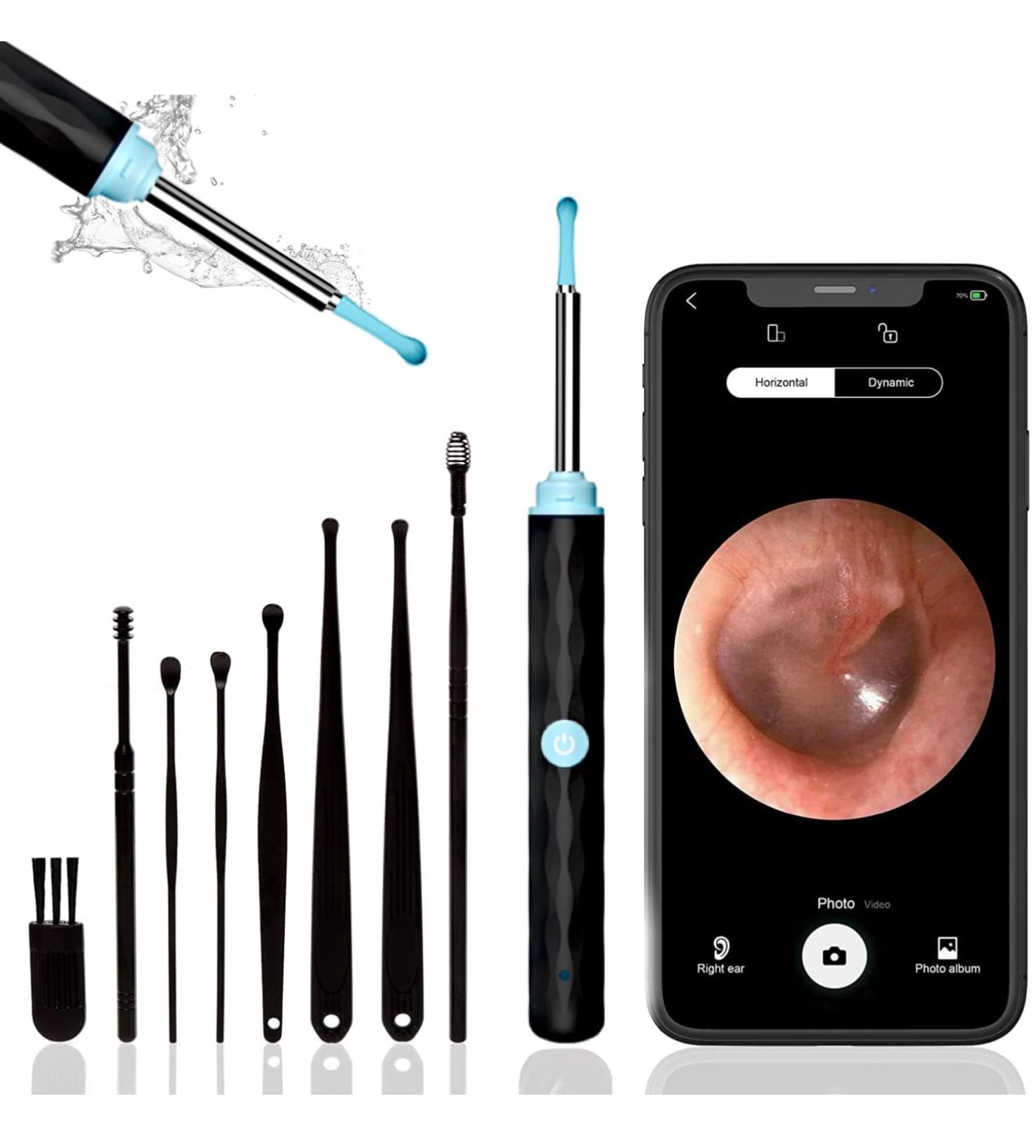 Ultimate Ear Wax Removal Kit with 1296P Camera Safe & Easy Ear Cleaner for iPhone iPad & Android - 9 Picks & 8 Tools Included - Buy Online on GoSupps.com