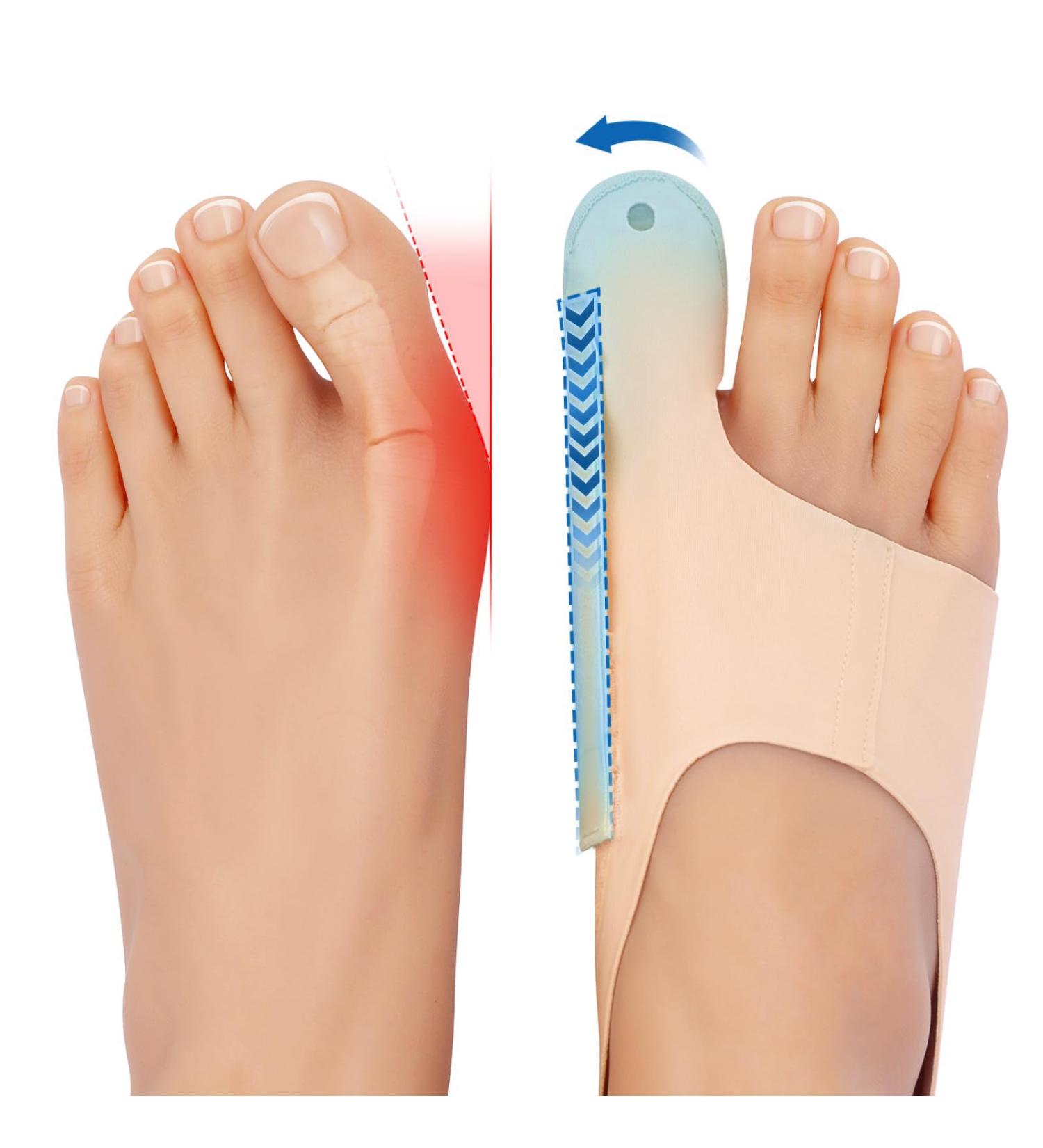 DNShan Medium-Sized Adjustable Bale Corrections - Ultra-Thin Toe Protectors for Men & Women | Soft Bale Tooth Socks for Ultimate Comfort in Shoes - M Nude - Buy Online on GoSupps.com