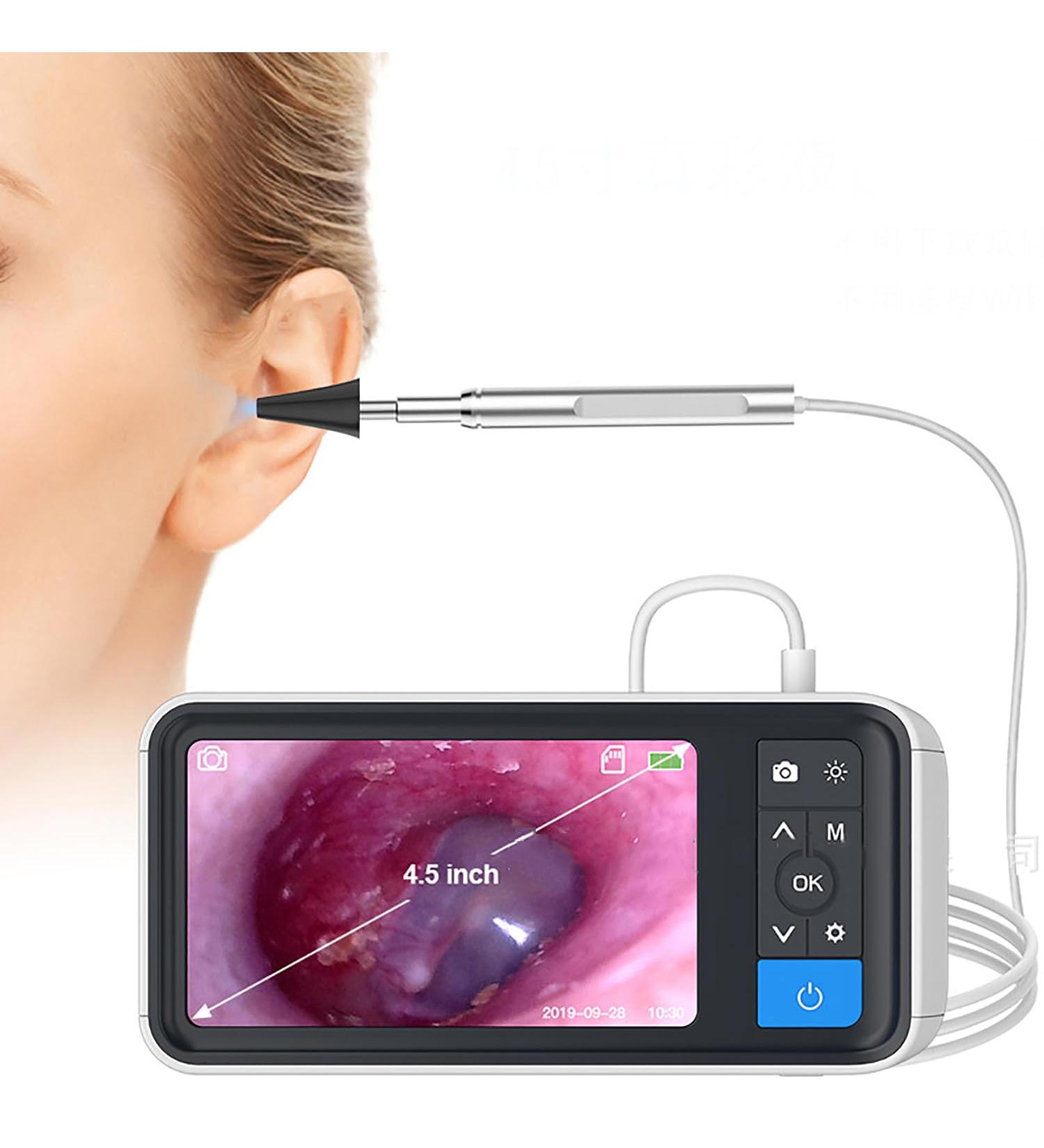BAIXDM Digital Otoscope Camera - 4.5 HD Screen 3.9mm Ear Scope with Light Photo & Video Recording - Buy Online on GoSupps.com