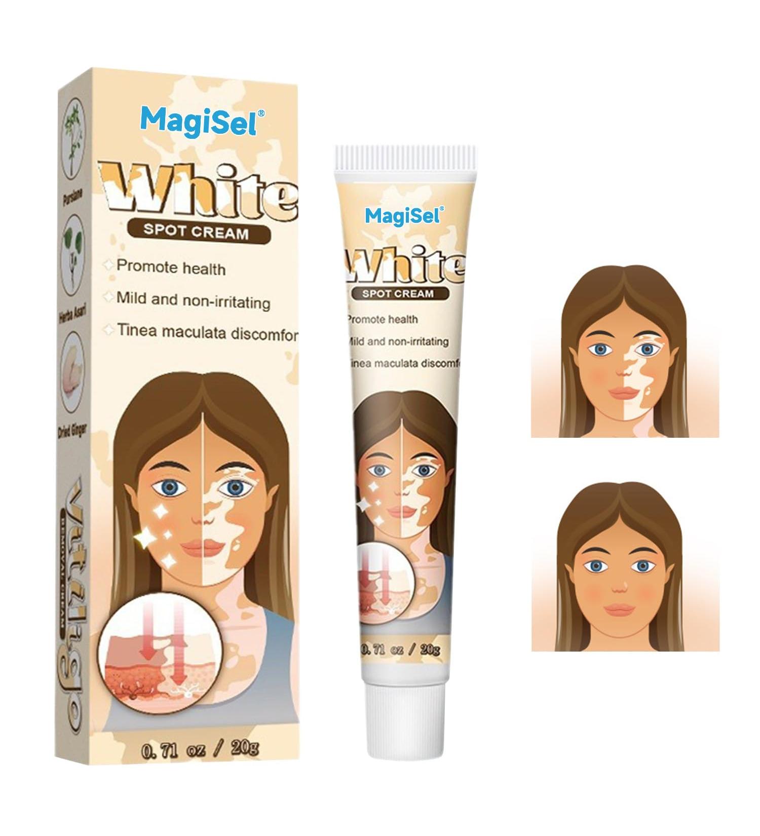  MagiSel Cream to repair white spots and pigmentation disorders hypoallergenic skin cream and pigment gel for skin with white spot disease promotes an even skin tone. - Buy Online on GoSupps.com