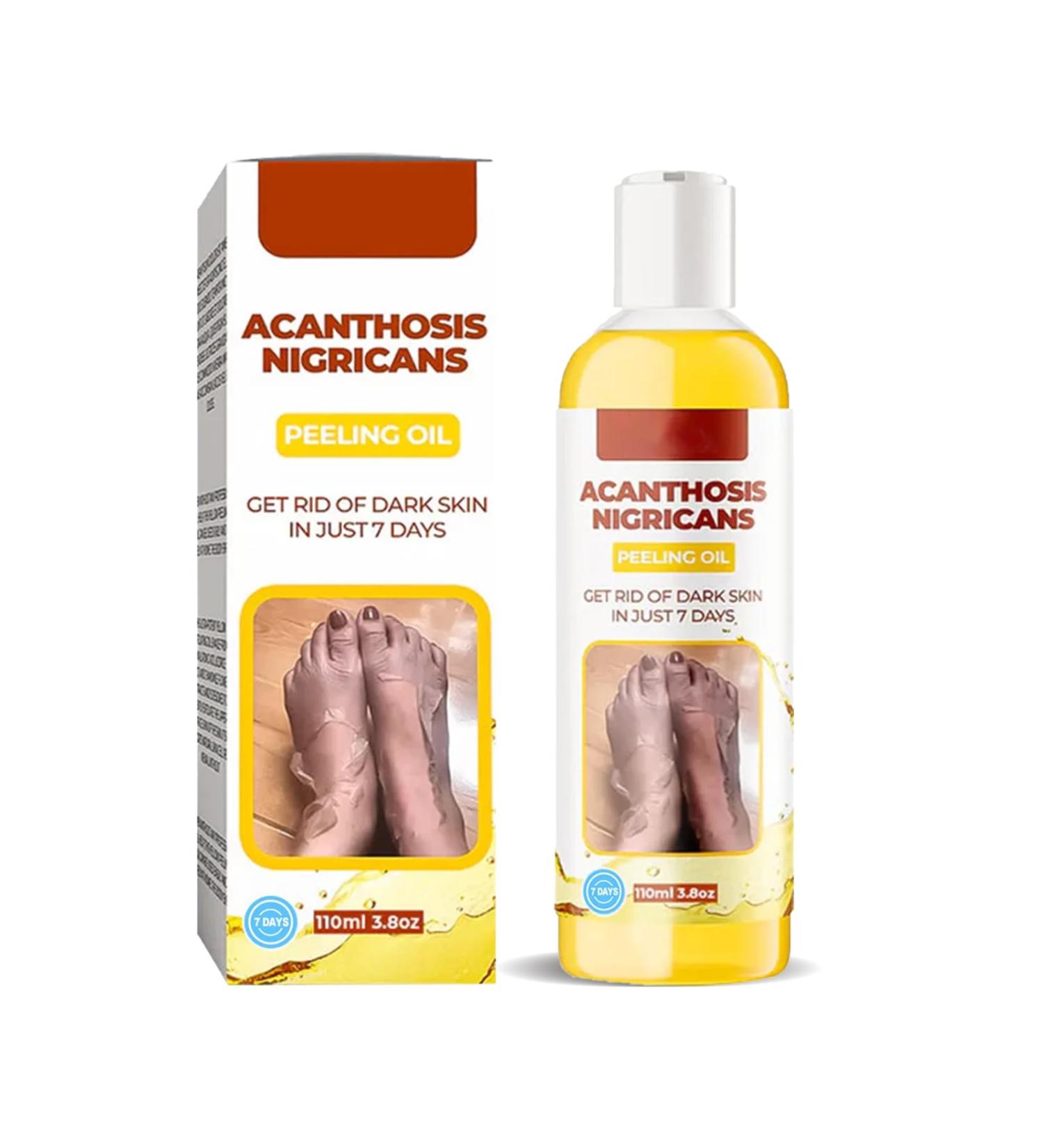 Extra Strong Peeling Oil - Chemical Exfoliant for Face & Body | Reduces Wrinkles Stretch Marks & Dead Skin - Buy Online on GoSupps.com