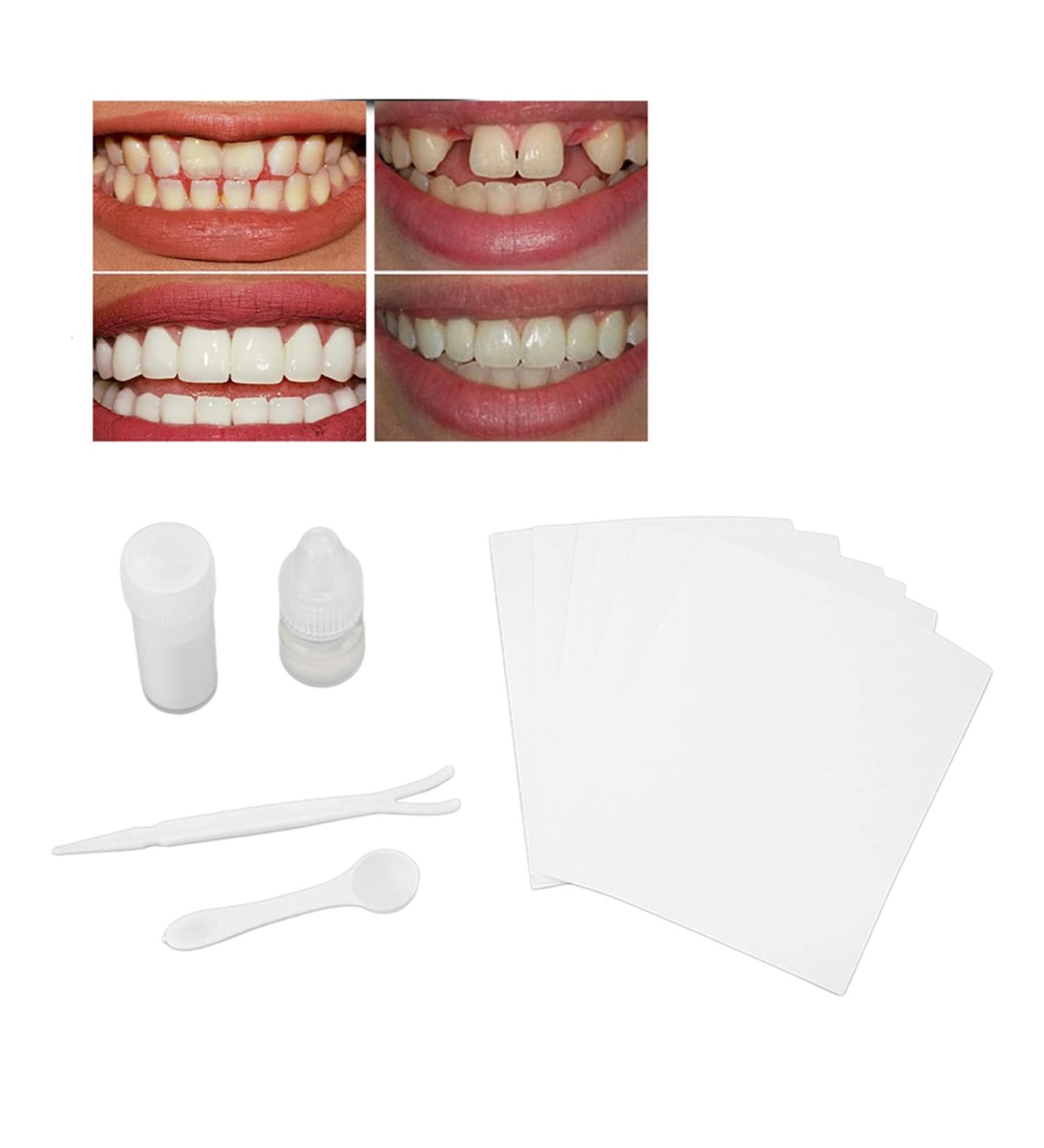 Emergency Tooth Care Set for Temporary Dentures | Dental Repair Kit for Missing or Broken Teeth - Buy Online on GoSupps.com