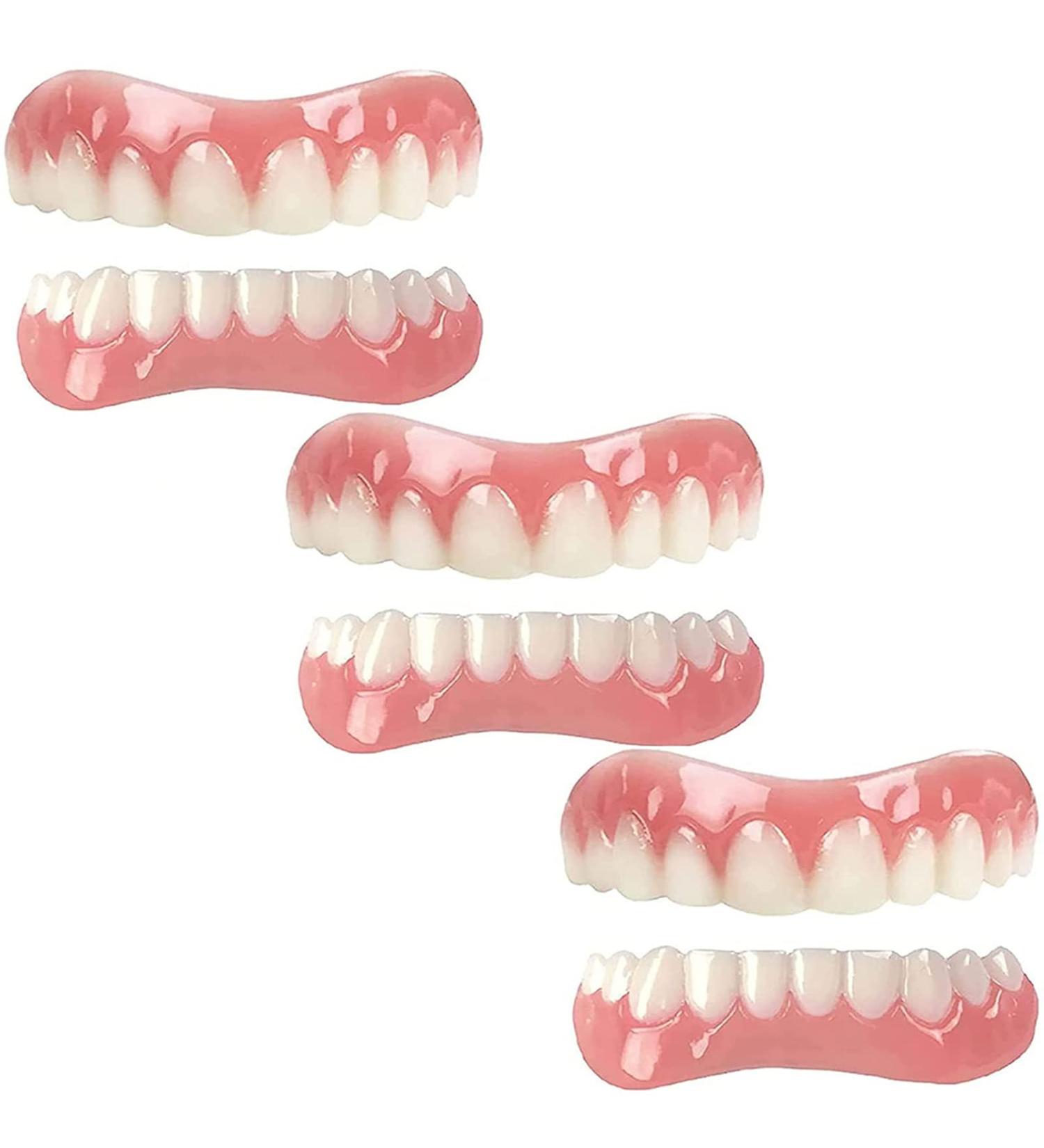 Denture Pebble Gel - Instant Repair for Upper & Lower Jaw | 3 Pairs for Confident Smiles | Quick & Easy Provisional Dentures - Buy Online on GoSupps.com