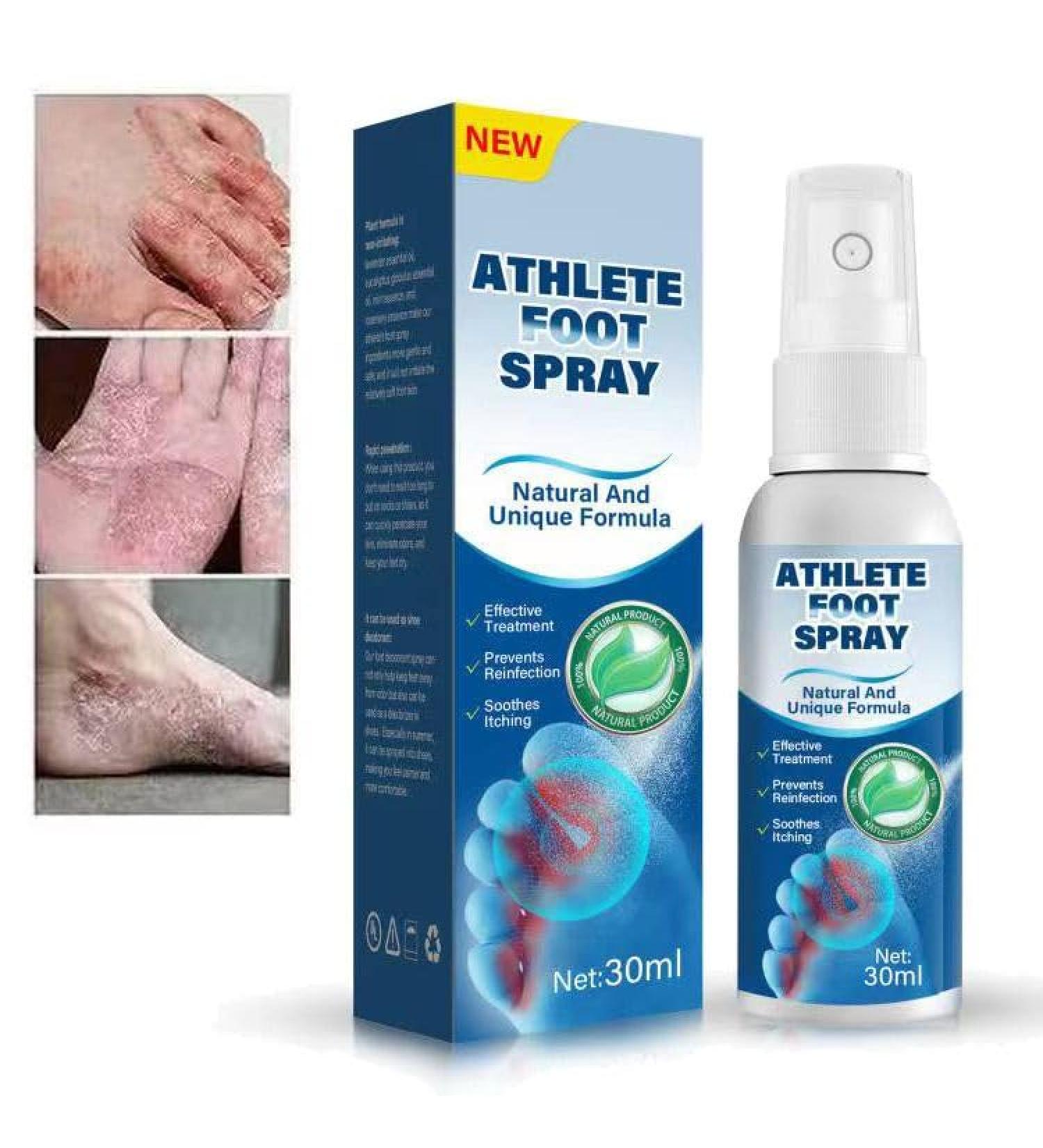 iTecFreely Athletes Foot Spray - Natural Treatment for Fast Relief from Itchy and Inflamed Feet - Buy Online on GoSupps.com
