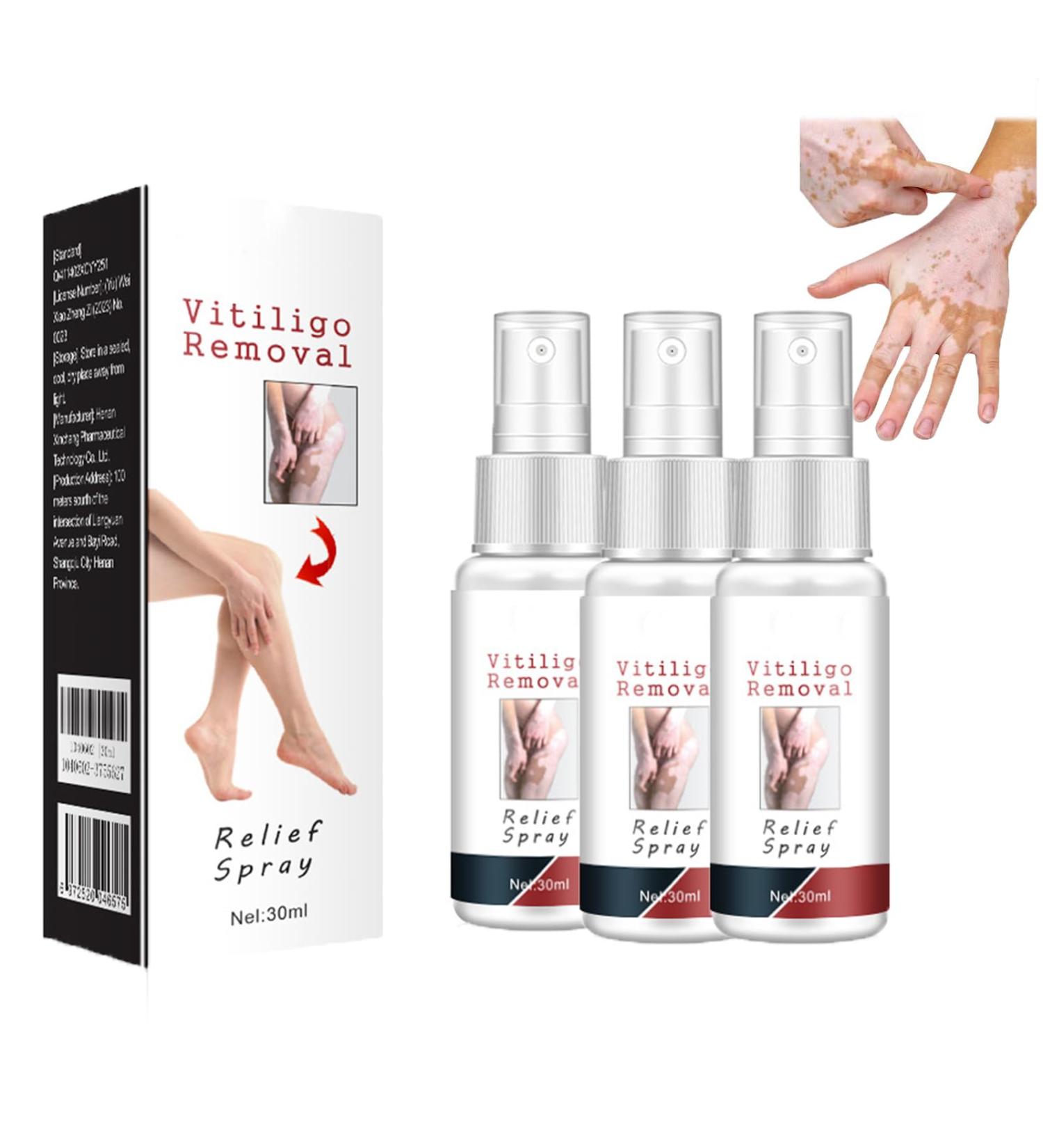 Vitiligo Removal Relief Spray - Reduces White Spots on Skin - 3pcs - Buy Online on GoSupps.com