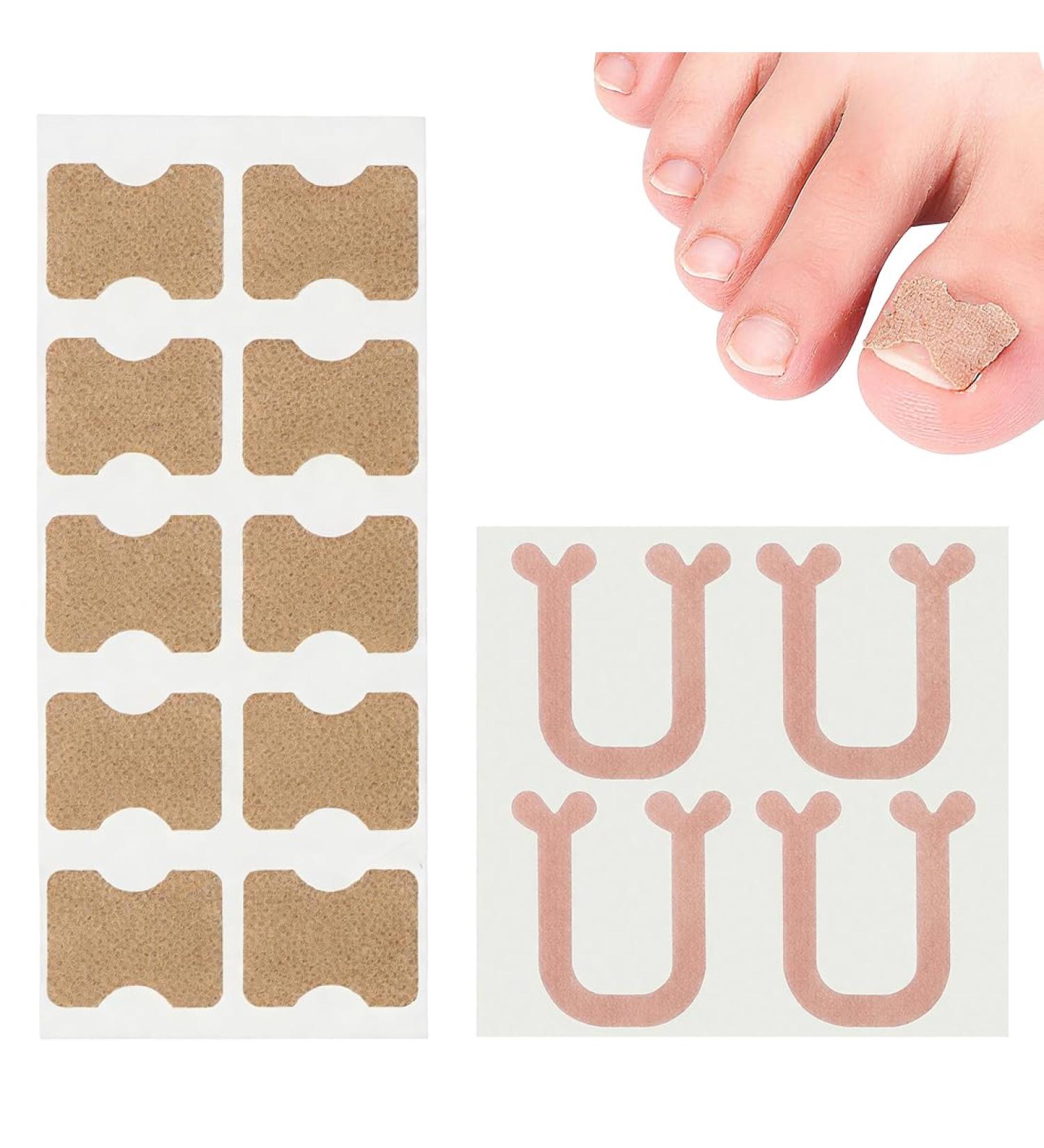 Correcteur pour Ongles Incarn s 80 Pi ces Patchs pour Ongles Incarn s Soulagement de la Douleur et Correction Naturelle Id al pour une Utilisation Quotidienne et Sportive - Buy Online on GoSupps.com