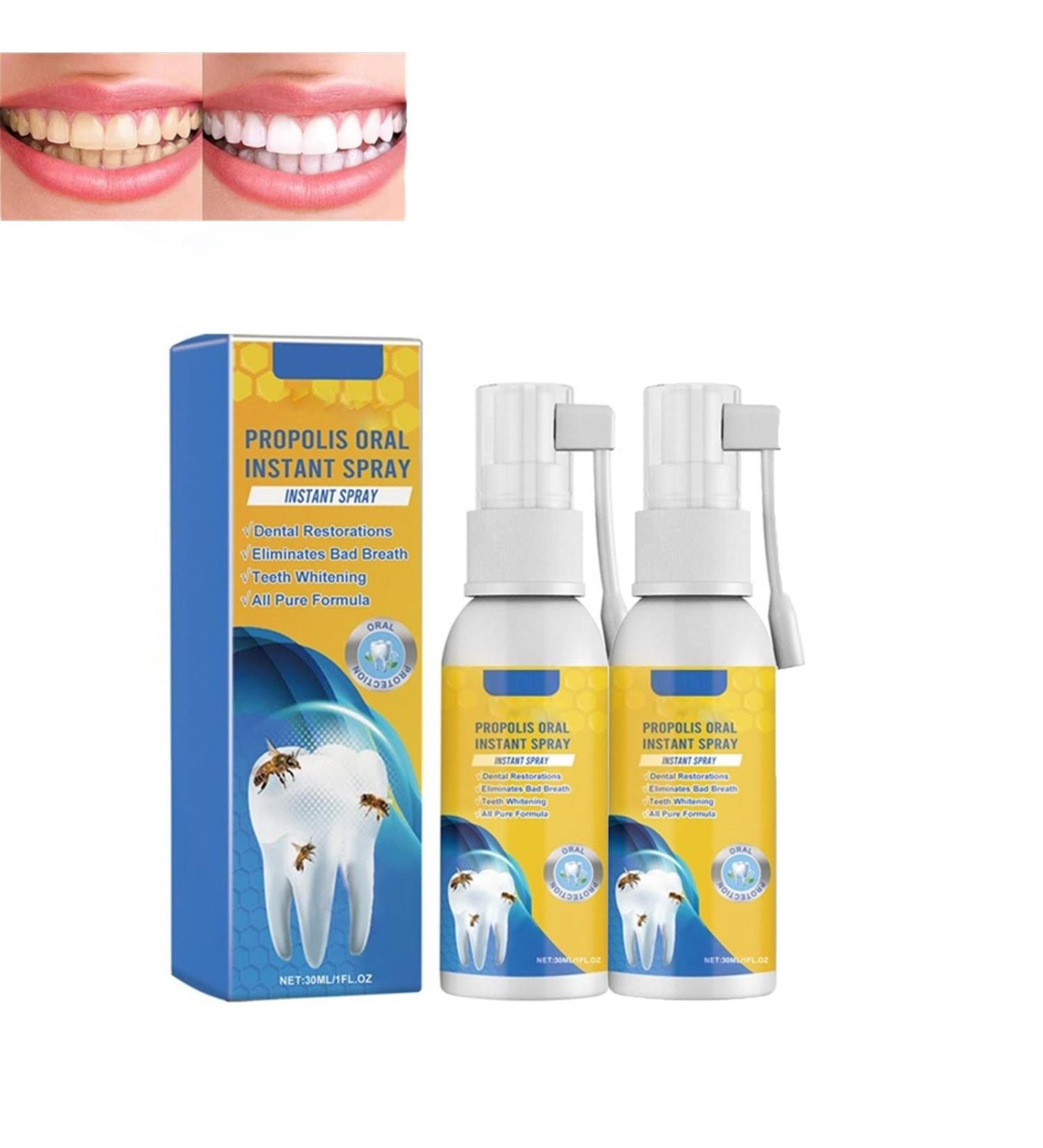 Propolis Oral Instant Treatment Spray - 2 Piece Set | Deep Cleaning Mouthwash & Refreshing Breath | Furzero Propolis Oral Health - Buy Online on GoSupps.com
