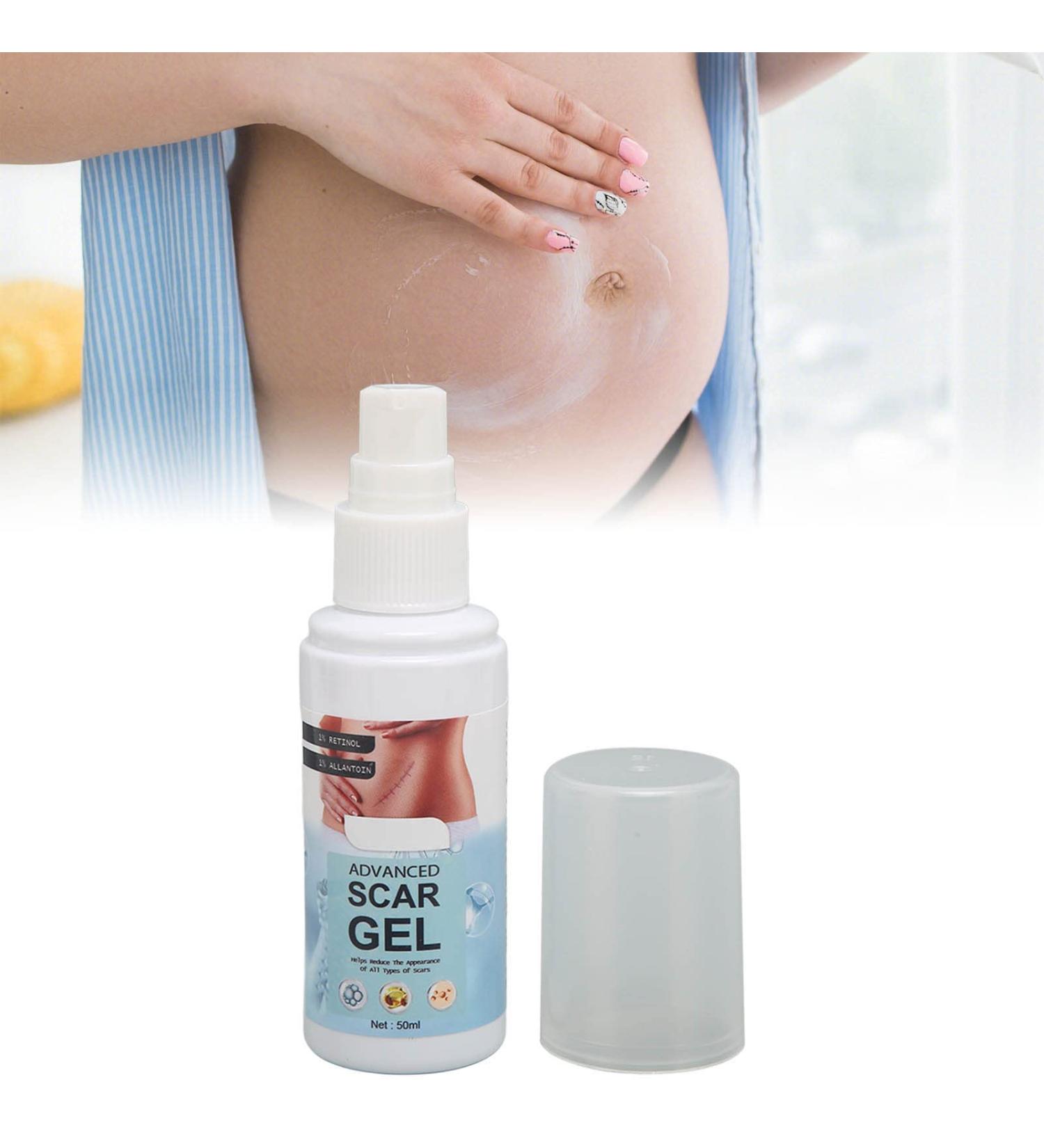 Stretch Mark Gel 2Pcs 50ml with Allantoin & Vitamin E - Hydrating Scar Remover for Scars, Burns & Surgery - Buy Online on GoSupps.com