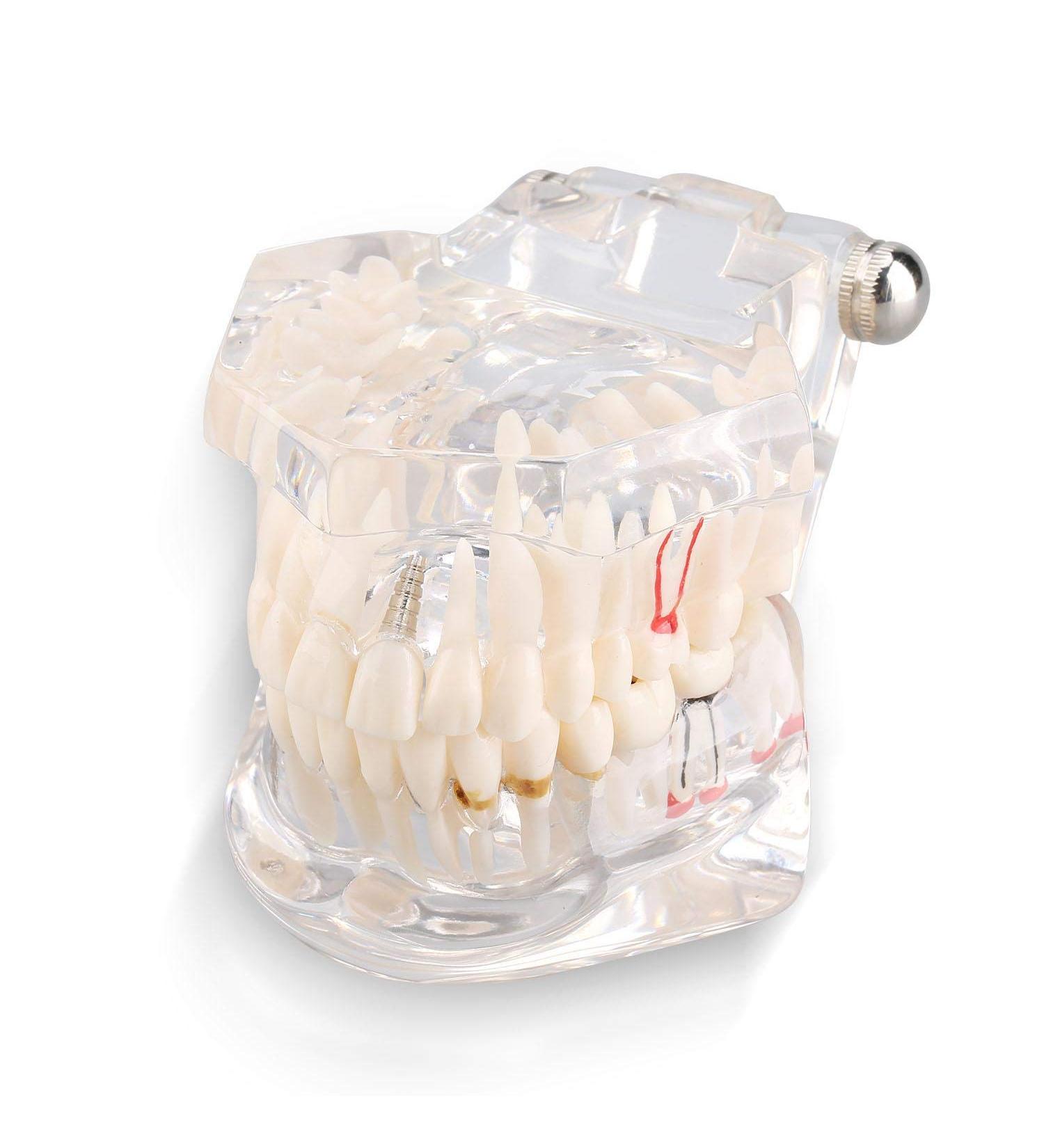 Teeth Model for Dental Teaching & Research | Realistic Adult Teeth Demonstration | No Brand - Buy Online on GoSupps.com