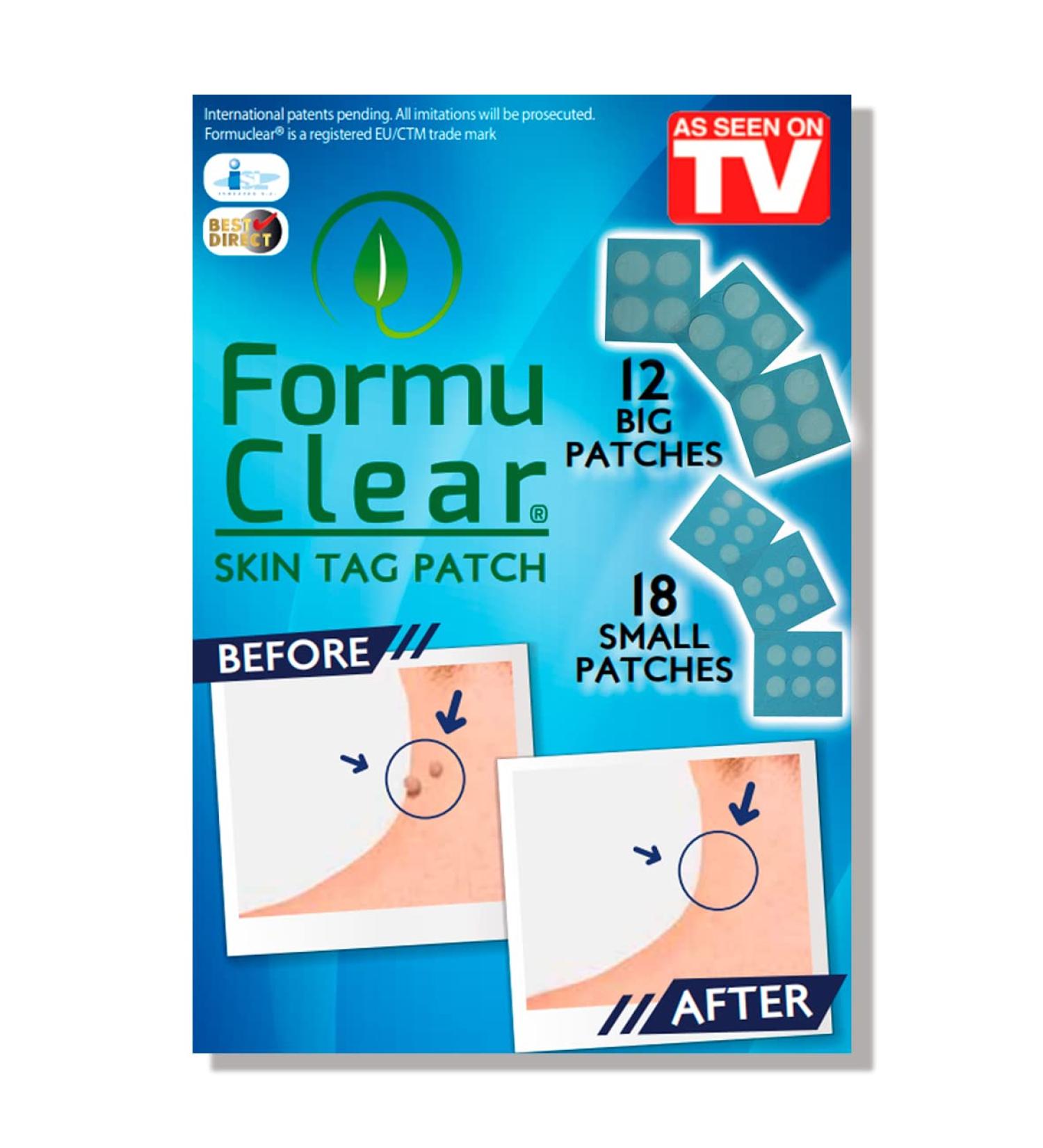 BEST DIRECT FormuClear Original Skin Tag As Seen On TV Box of 30 Patches to Remove Warts Skin Tags Natural and Painless Solution Medical Plaster Rich in Salicylic Acid - Buy Online on GoSupps.com