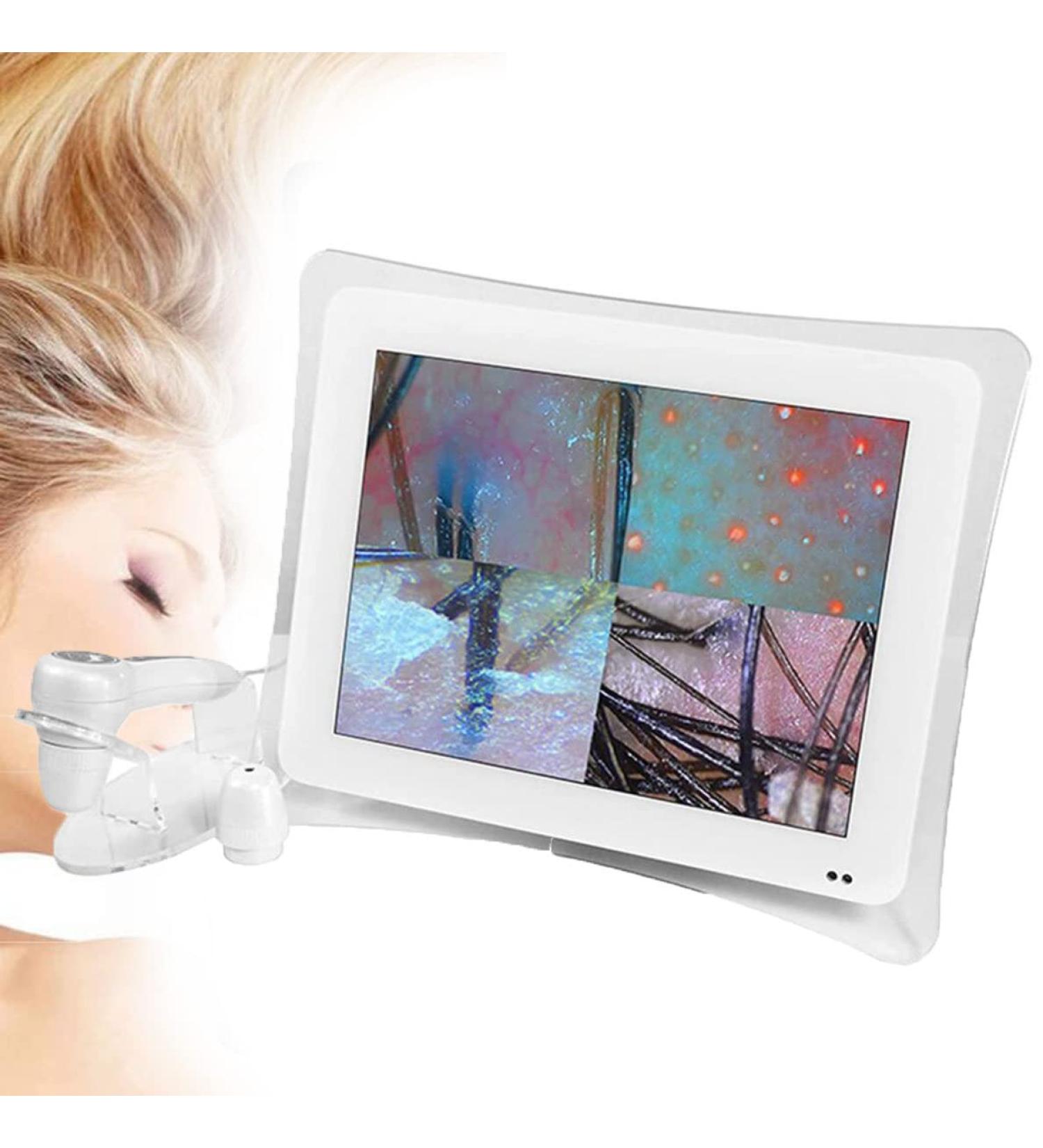 15 Inch Scalp Hair Follicle Detector 50X 200X Skin Hair Scalp Detector Multi Functional High Definition Rechargeable Skin Scalp Hair Follicle Detector - Buy Online on GoSupps.com