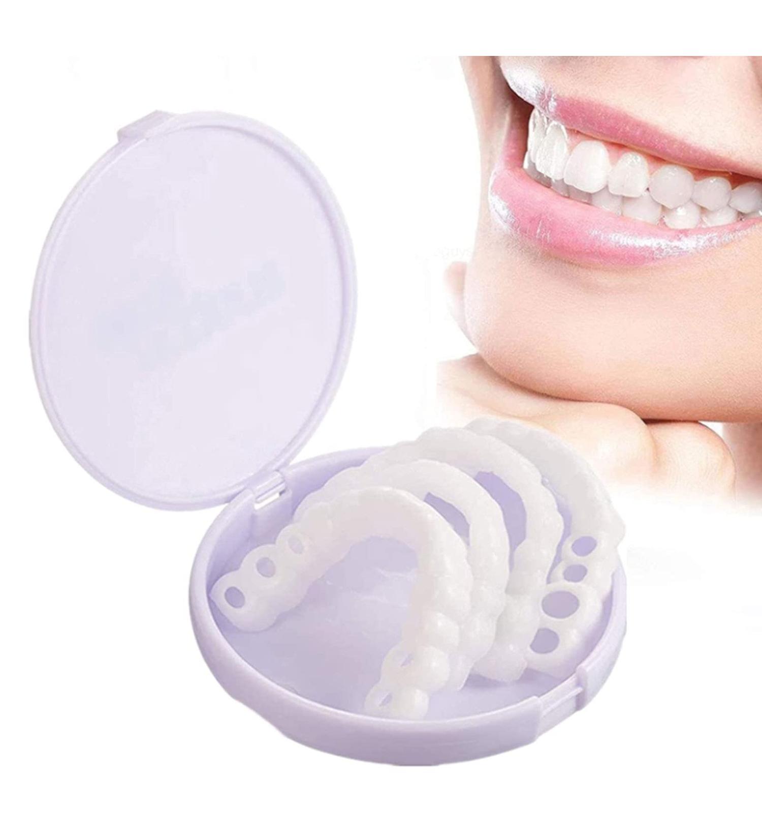 icehao Upper & Lower Teeth Veneers - Simulation Braces Snap On Smile Tooth Cover for Perfect Whitening - One Size Fits Most Comfortable Denture - 2pcs Set - Buy Online on GoSupps.com