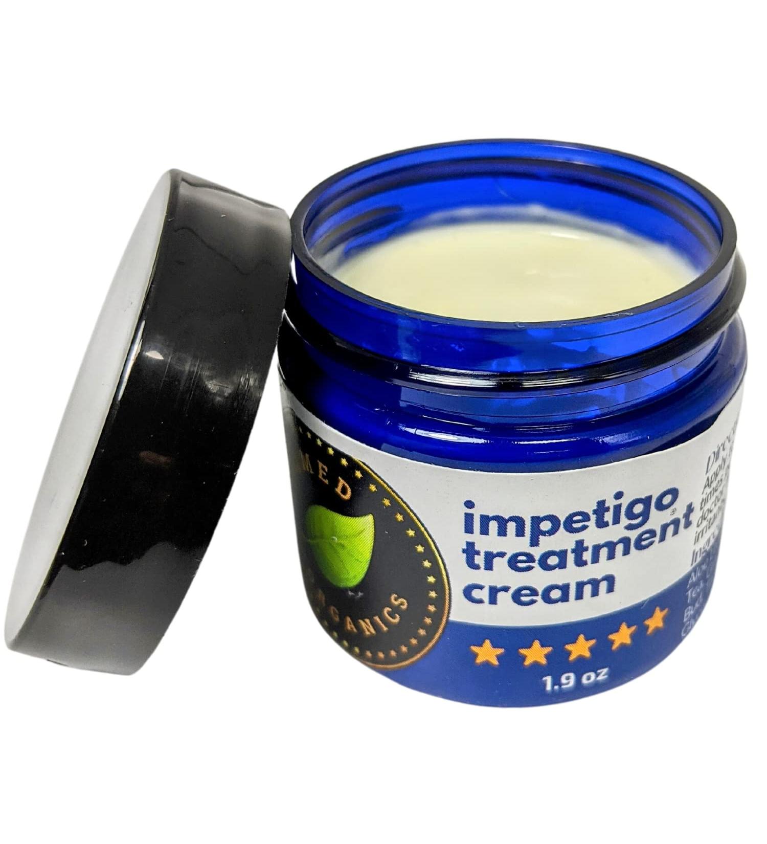 Tamed Organics Impetigo Symptom Relief Cream - Fast Acting Natural Formula - 1.9 oz - Anti Itching & Scarring - For Adults & Children - Buy Online on GoSupps.com