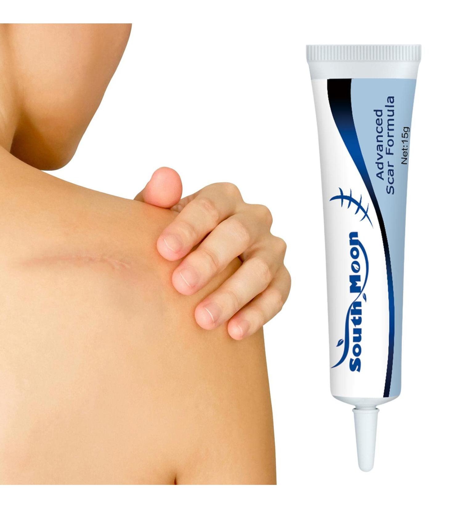  Tebinzi Scar gel anti-scar cream for face and body Nourishing treatment for surgical scars cesarean scars burns keloids and hypertrophic scars - Buy Online on GoSupps.com