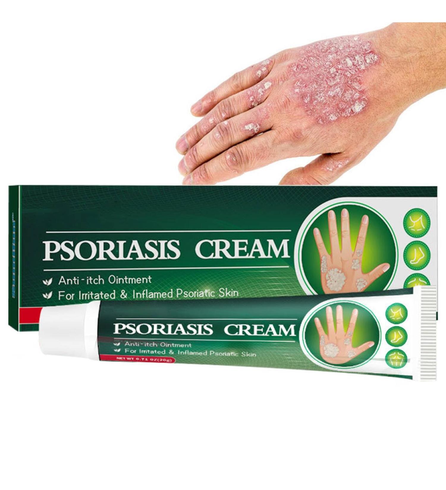  MagiSel Ringworm cream soothing anti-itch cream ready-to-use cream body cream for redness and itching relief skin itching relief - Buy Online on GoSupps.com