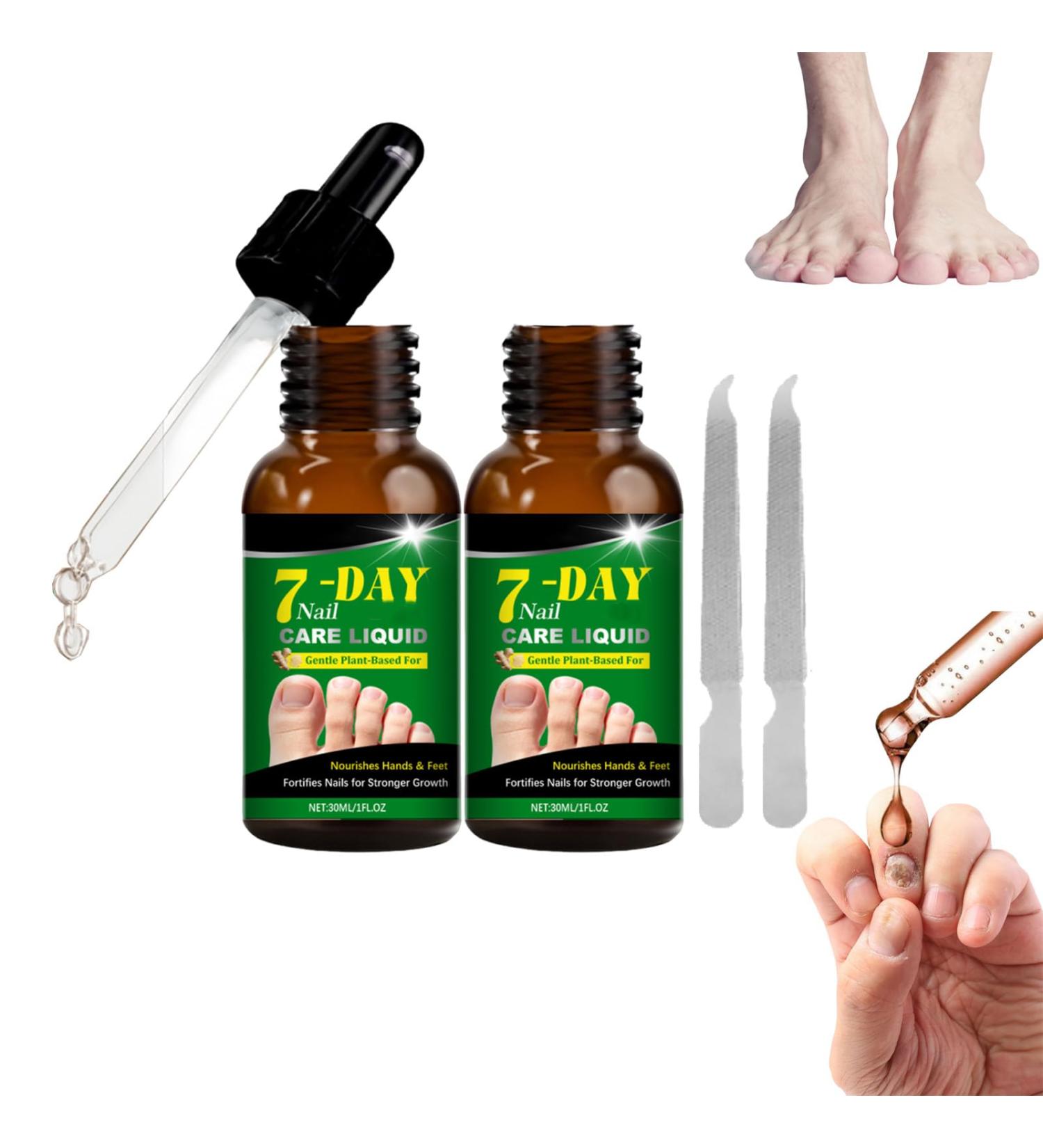 VKaoess Ginger nail essence with strengthener and cuticle oil Growth care for damaged and weak nails Extra strong hardener and thick toenail softener Includes brightener 30ml 2 bottles - Buy Online on GoSupps.com