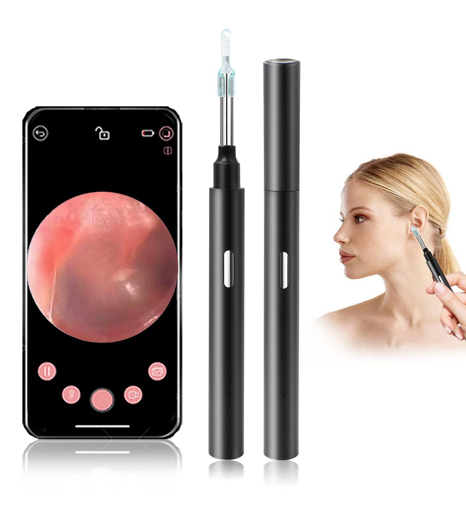 LOOYUAN Wireless Ear Wax Removal Endoscope with LED Lights - Visual Ear Scope and Cleaner for Kids and Adults, Android iOS Compatible - Buy Online on GoSupps.com