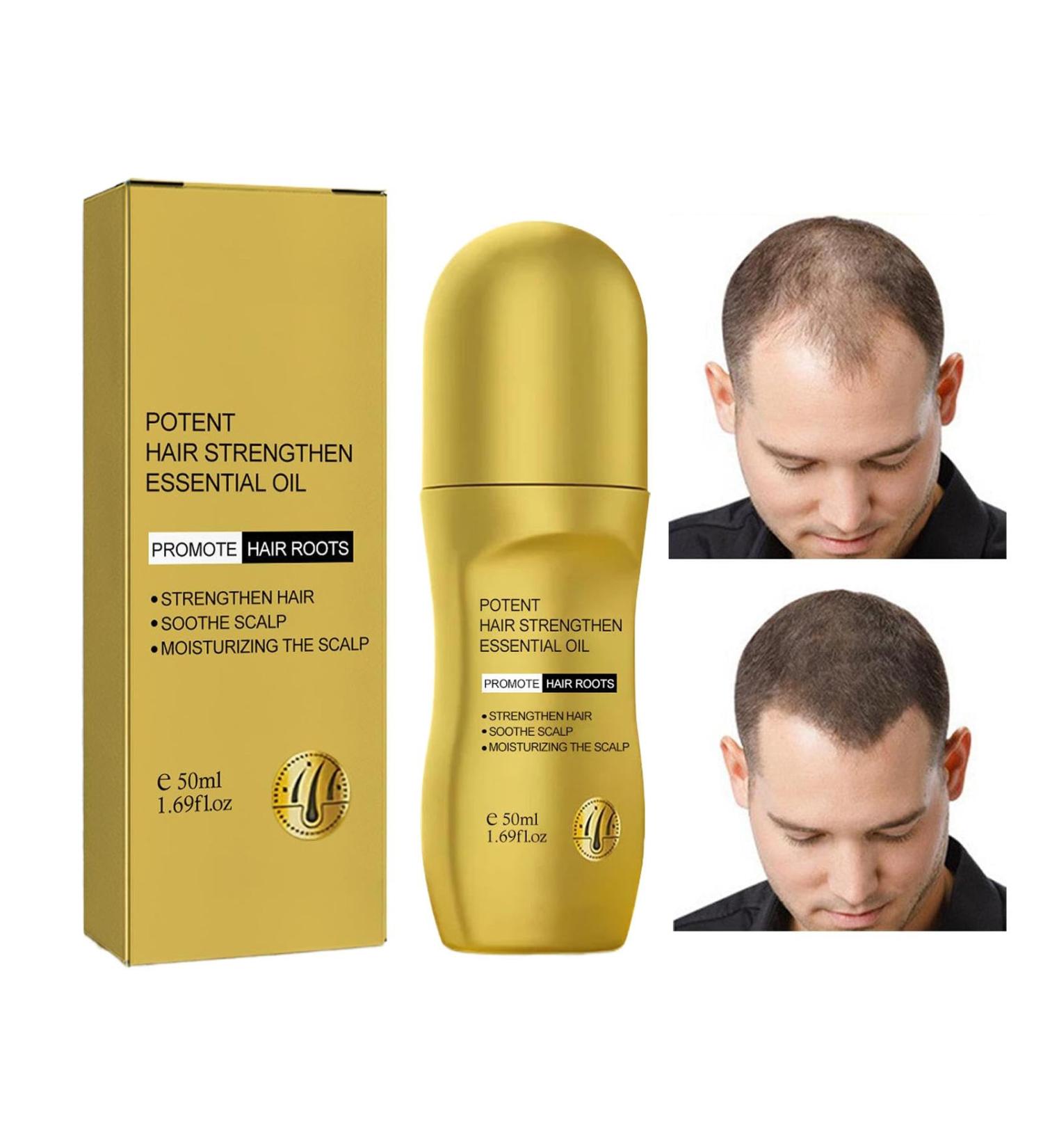  G n rique Hair Thickening Oil Scalp Moisturizer For Hair Loss Hair Strengthening Oil Rollerball Scalp Hair Loss Oil Scalp And Hair Oil 50ml Hair Thickening Oil Hair Repair Oil For Damaged Hair  - Buy Online on GoSupps.com