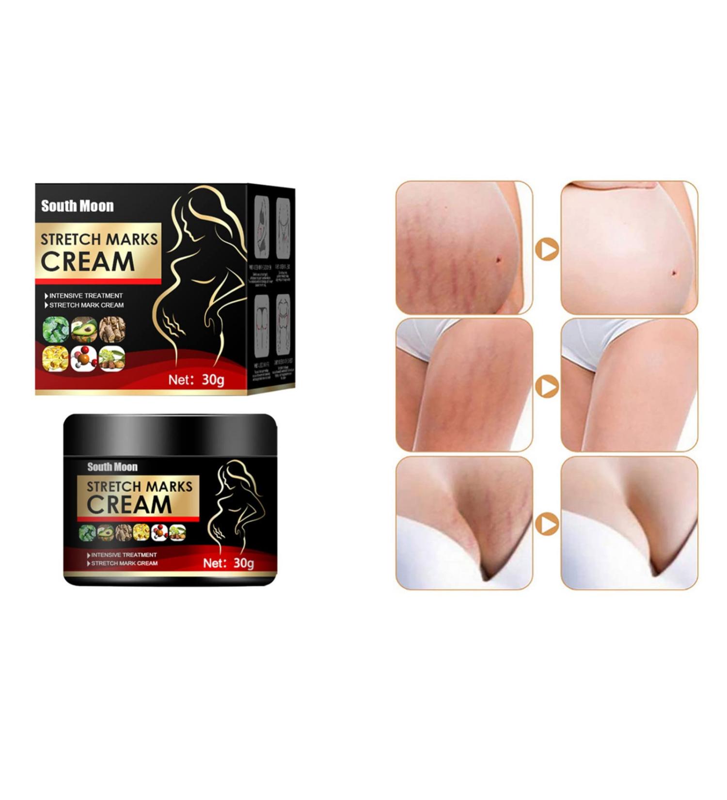 Formation Scar Wrinkles Formation Scar After 30g Fades Wrinkle Scar Removal Formation Out Scar Scar Formation Oily Skin Control 4*4*4cm A3-Black