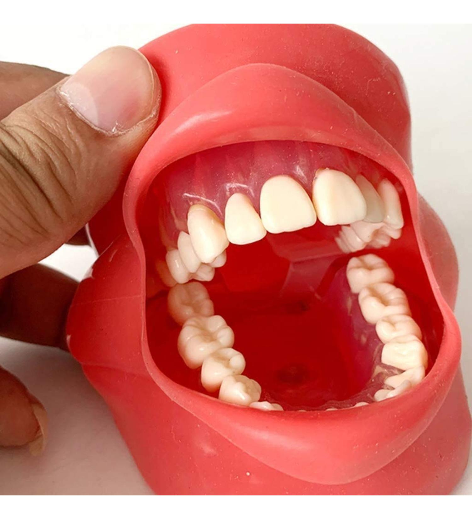 Gylejwh Dental Implant Teeth Model - Realistic Oral Simulation for Dental Training & Practice - Buy Online on GoSupps.com