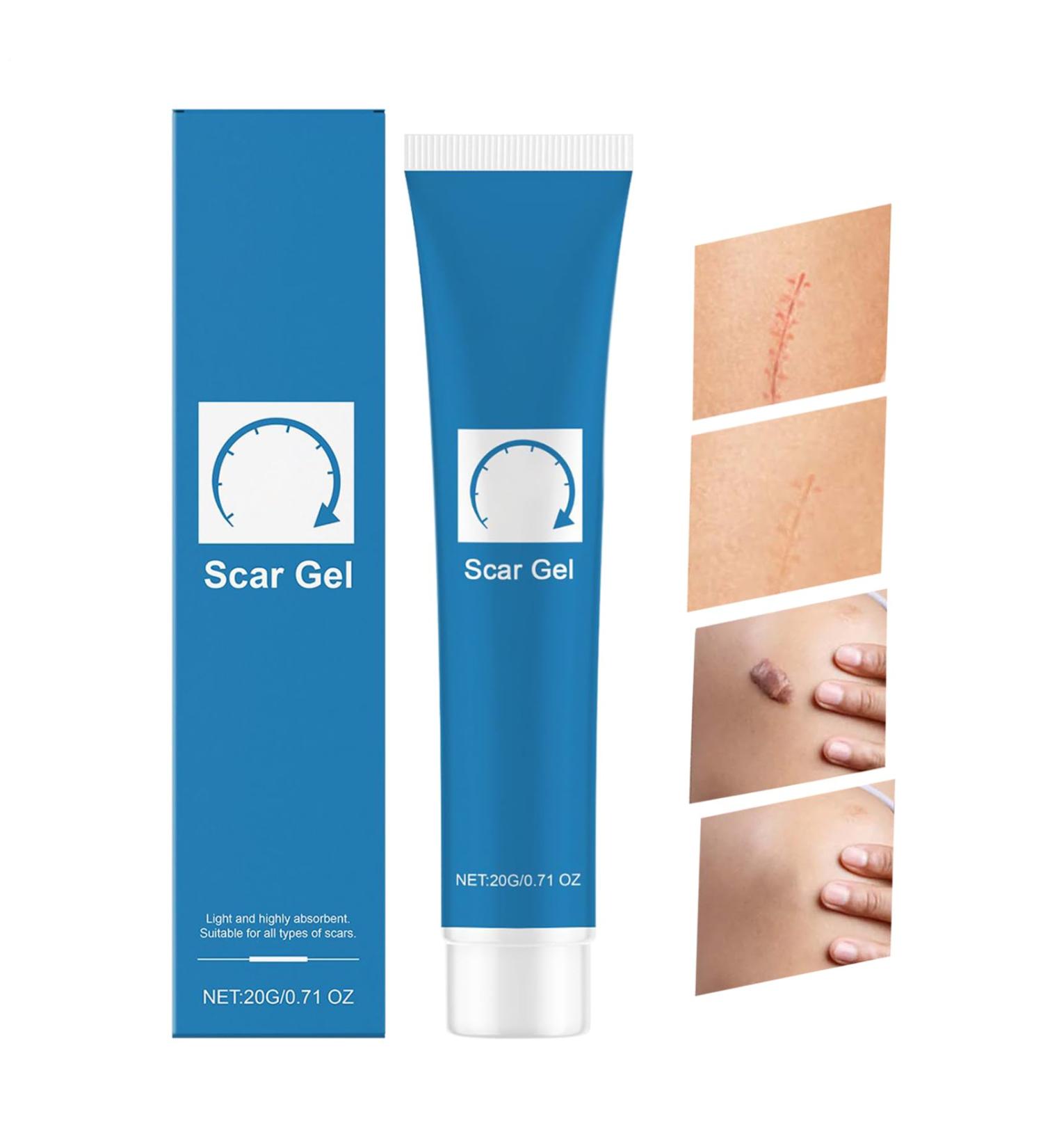 Scar angel scar repair and removal 20 grams burn scar cream for surgical scars abdominal covering strengthening keloid dents in women and men against dark spots stretch marks - Buy Online on GoSupps.com