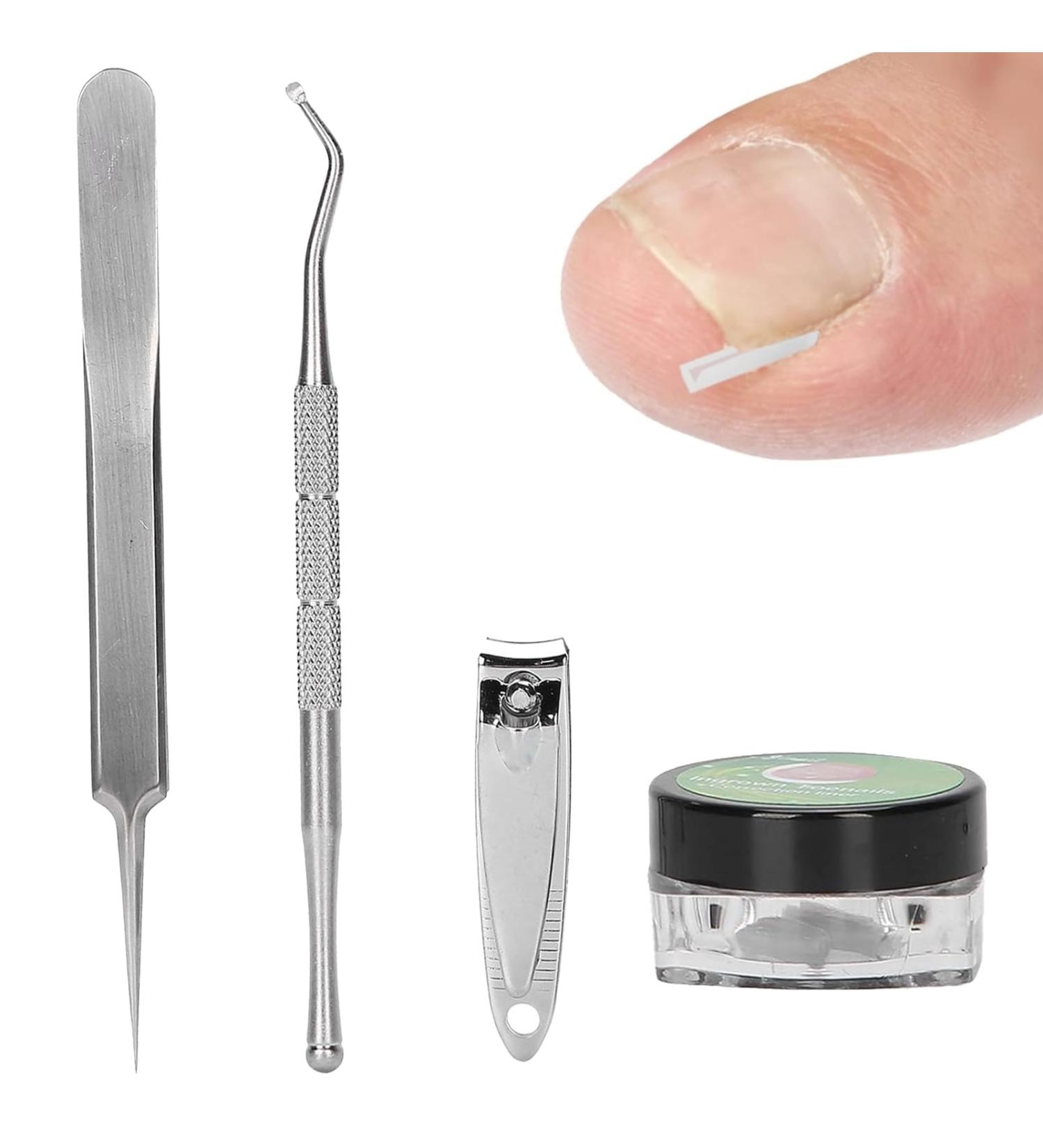 Ingrown Toenails Set Painless Nail Clip Toenails Ingrown Toenail Treatment Toenail Correction Including Nail Clippers and Other Accessories for Ingrown Toenails - Buy Online on GoSupps.com