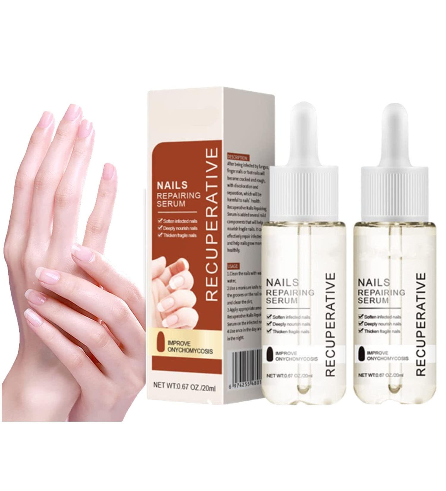 GFOUK 7 Days Nail Growth And Strengthening Serum Nail Growth and Strength Serum Nail Growth & Strengthening Oil Serum Stronger Nails in 1 Week Nail Strengthening Treatment (2 Pcs) - Buy Online on GoSupps.com