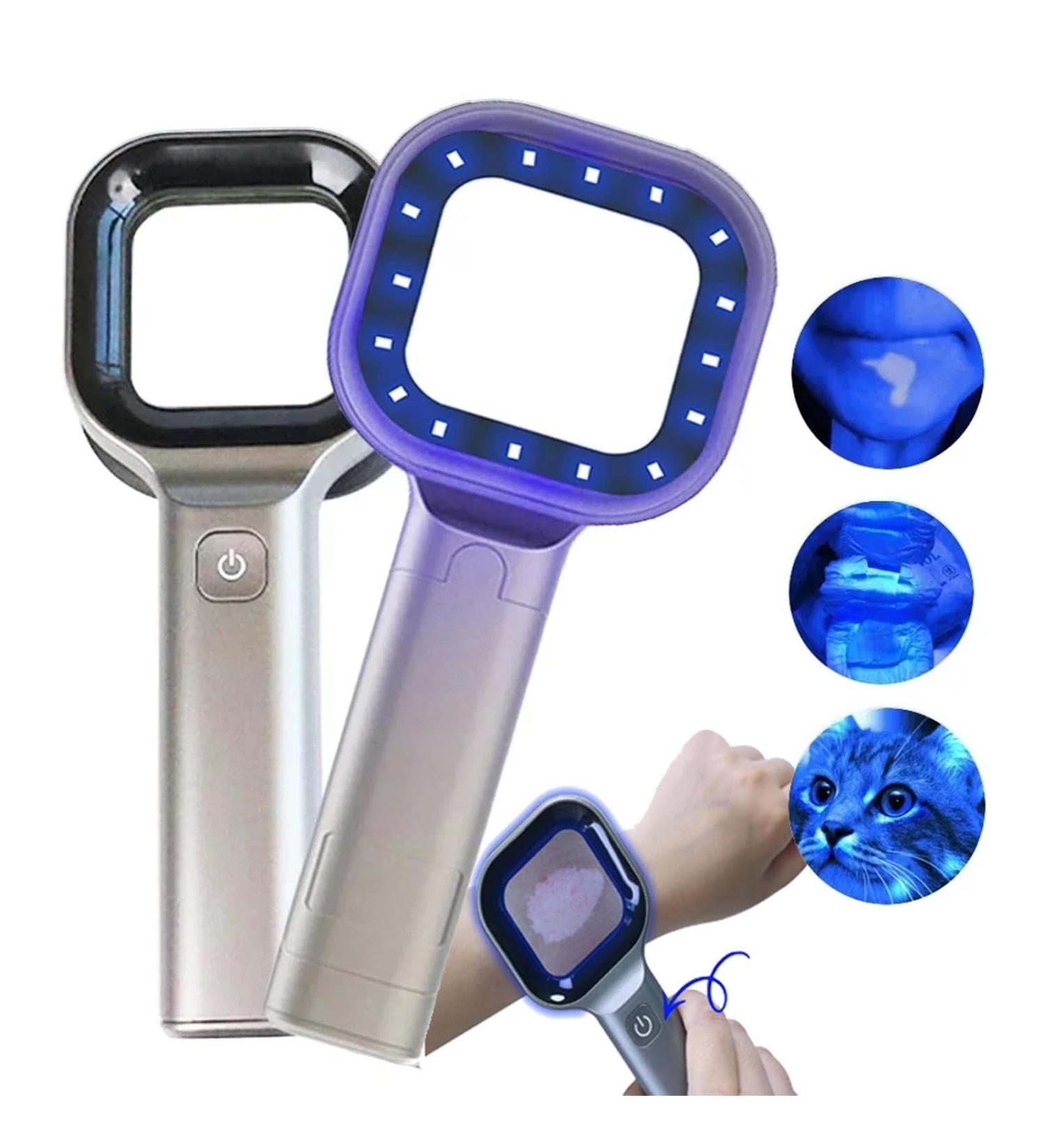 Woods Lamp Skin Analyzer- Visible Lens Area 40 * 40mm Portable Facial Salon Beauty Analyzer Magnifying Analyzer One-Key Operation Rechargeable 365nm for Skin Analyzing Testing Examination - Buy Online on GoSupps.com