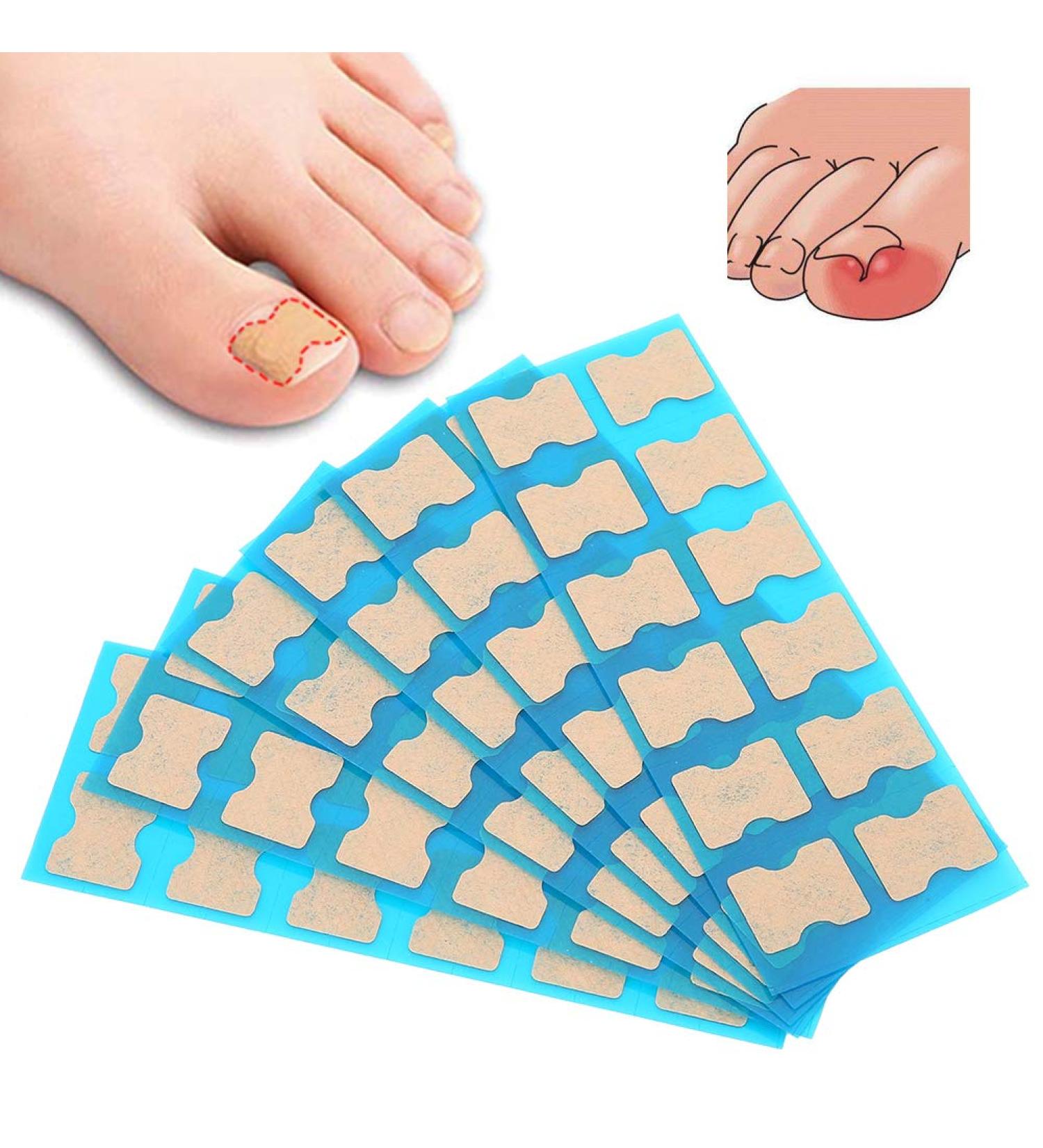 Toenail Corrector Patch Ingrown Toenail Corrector Toenail Correction Stickers Ingrown Toenail Correction Patch Foot Care Pedicure Sticker Toenail Treatment Tool for Foot Care (72 pieces) - Buy Online on GoSupps.com