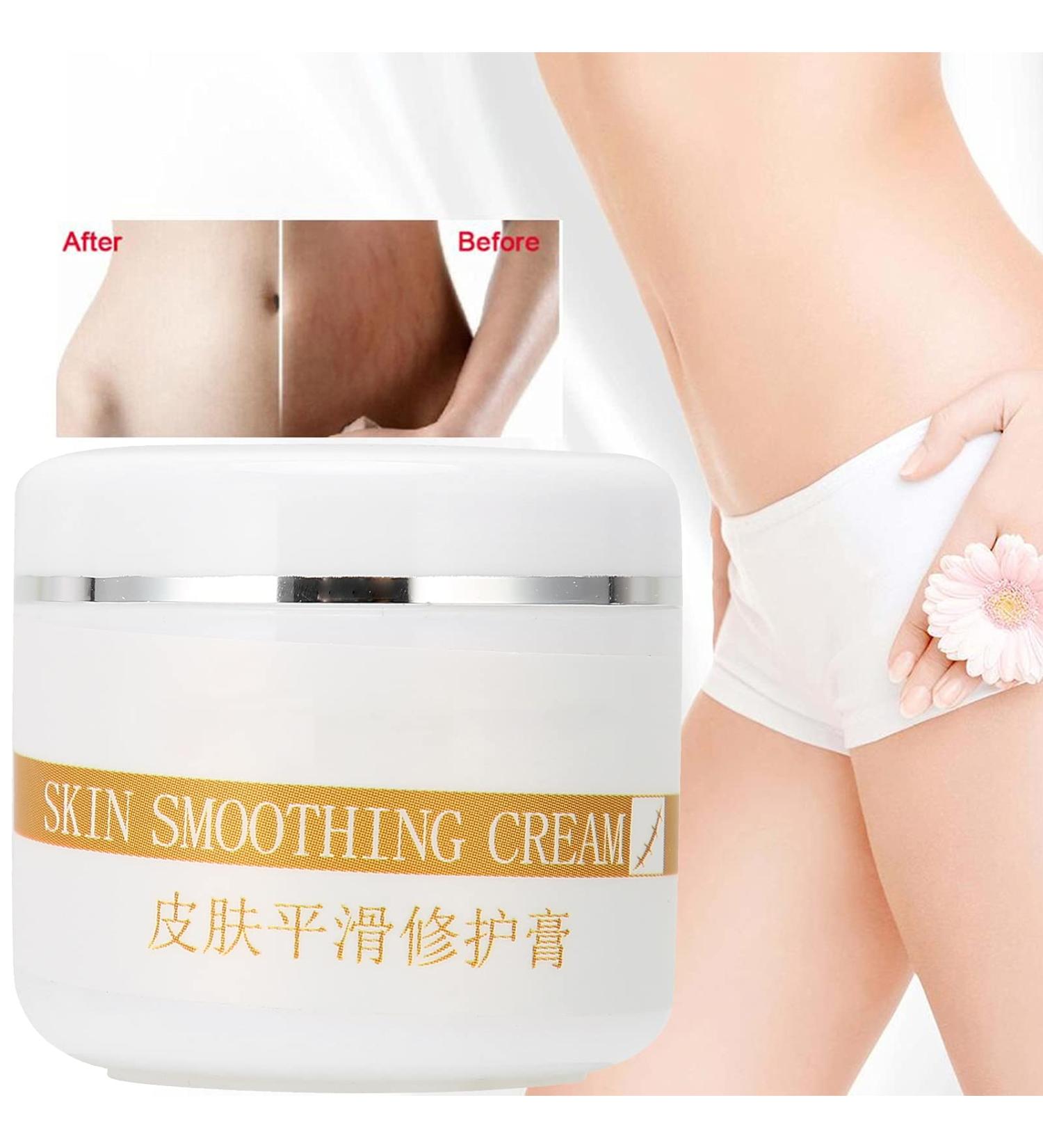 30g Scar Repair Cream | Effective Scar Removal Ointment for Stretch Marks, Burns, Acne | Skin Healing Treatment - Buy Online on GoSupps.com